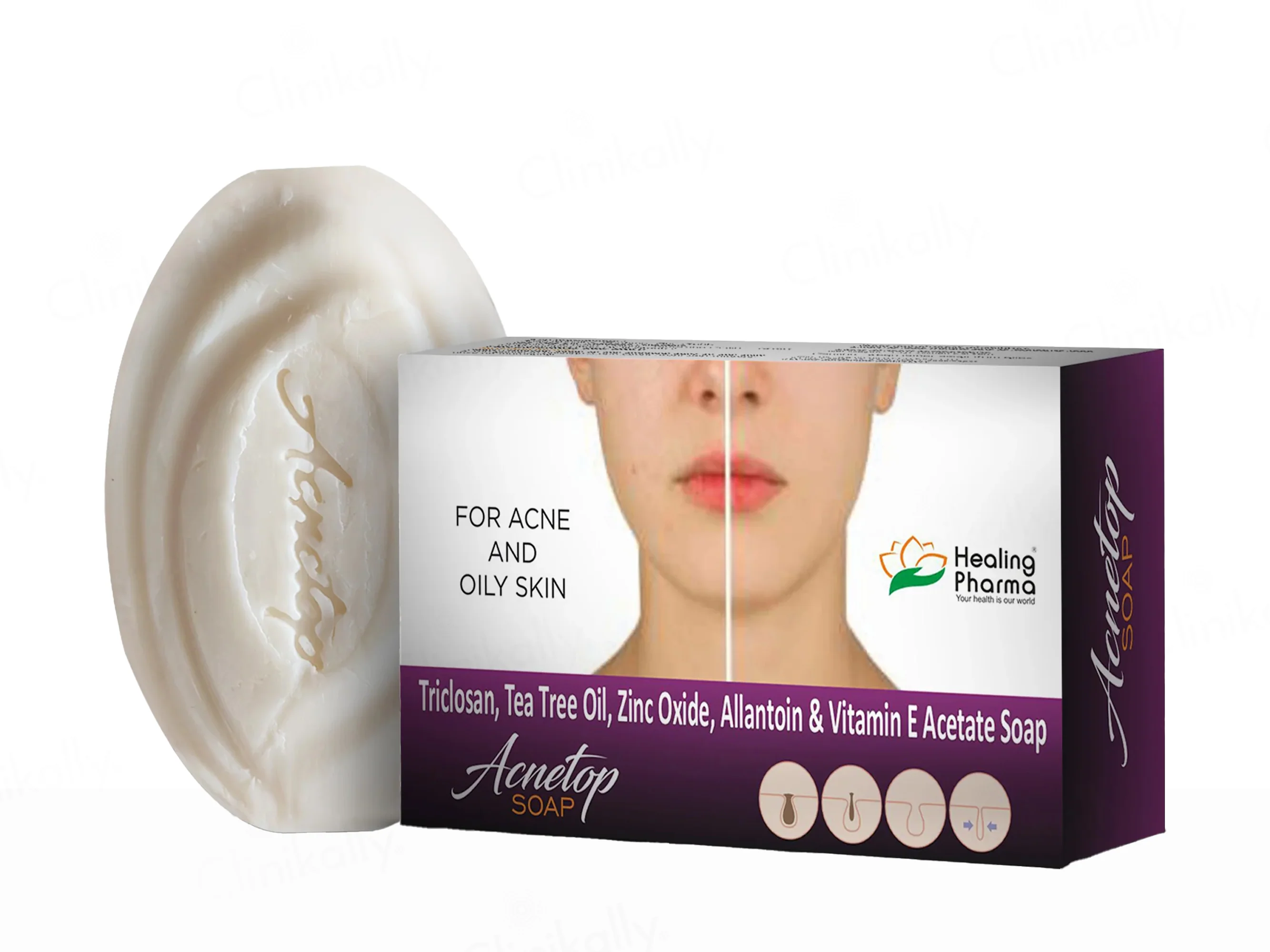Acnetop Soap - Image 3