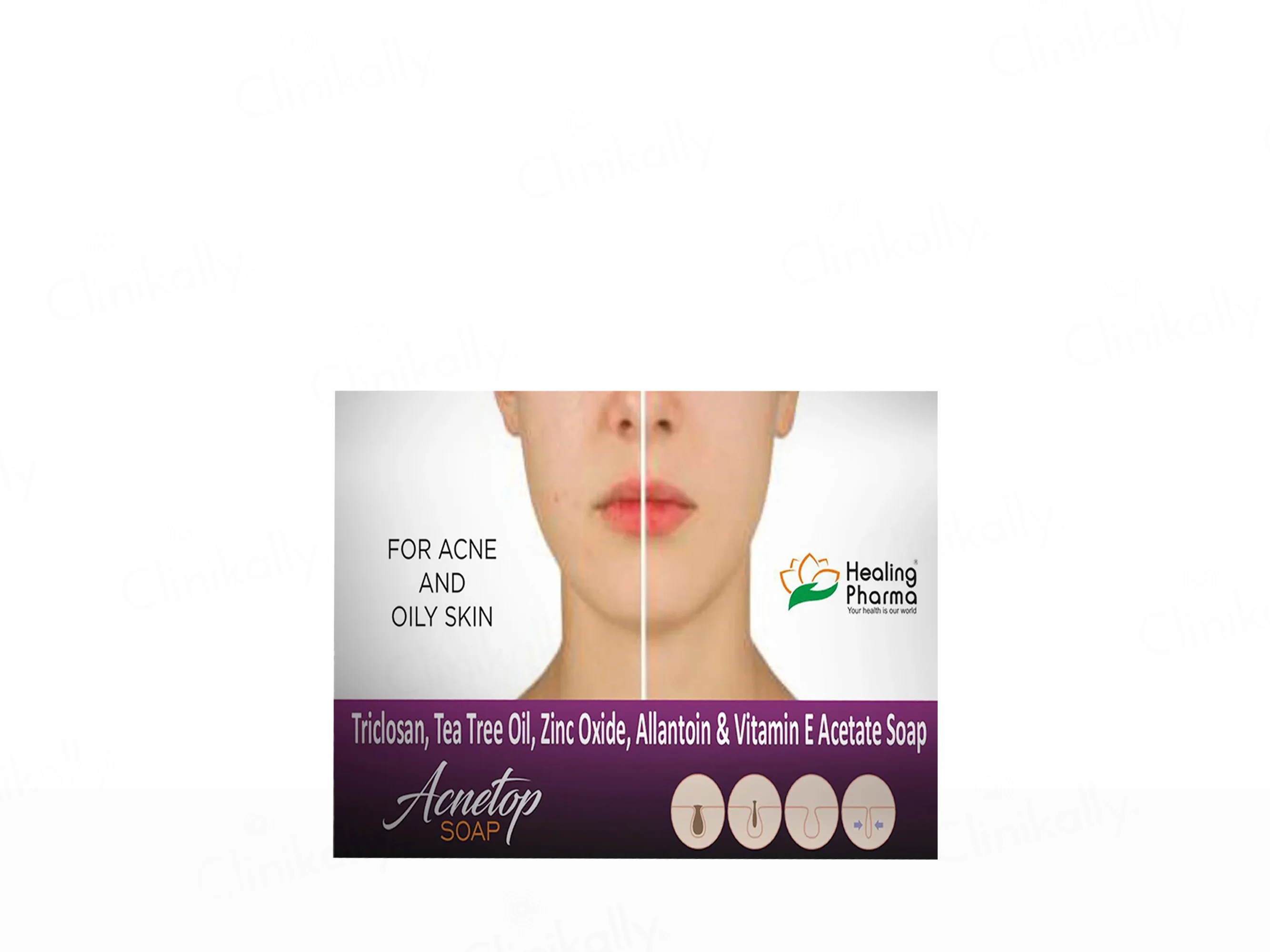 Acnetop Soap - Image 5