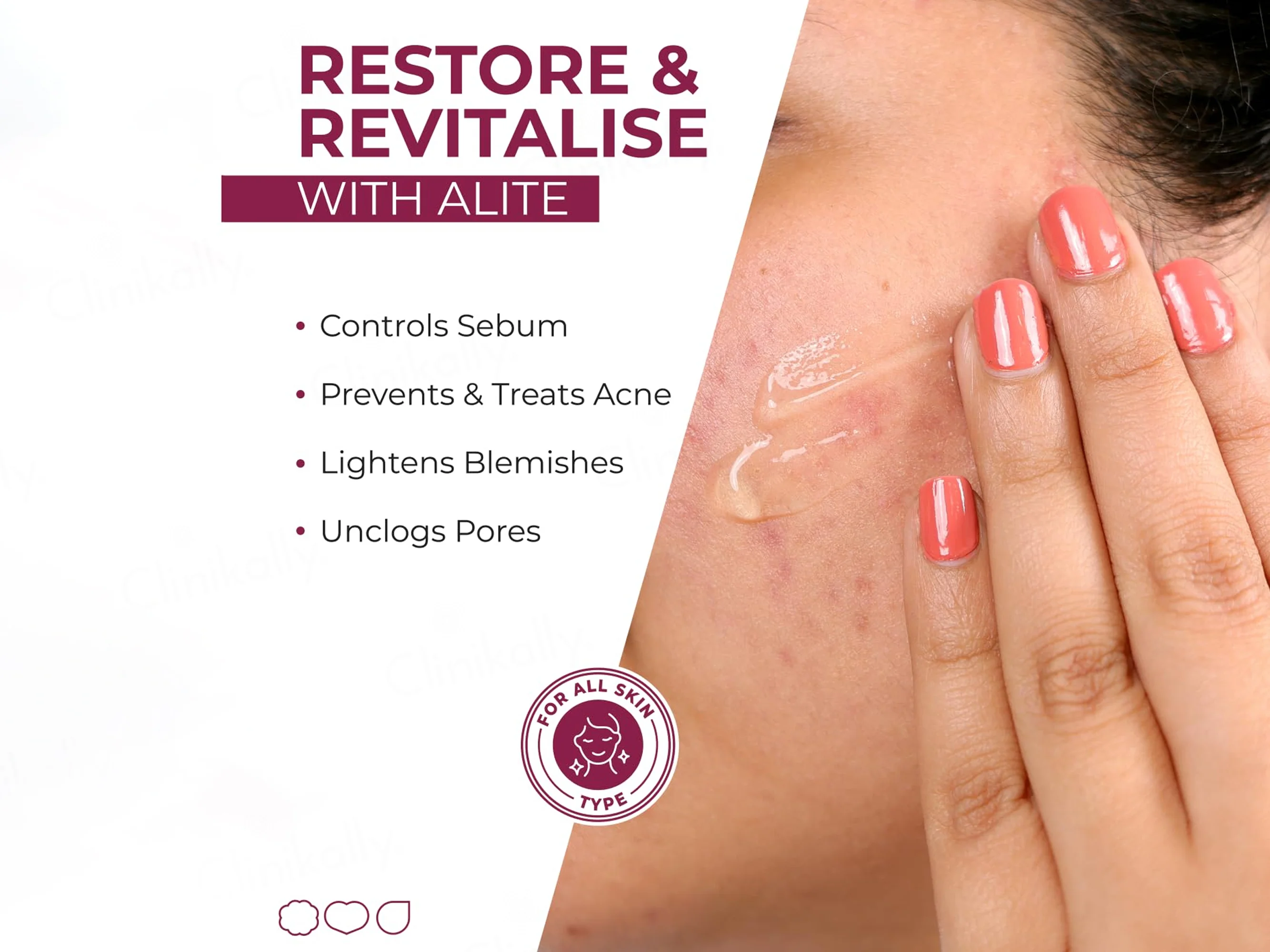 Alite Anti Acne Gel - Image 4