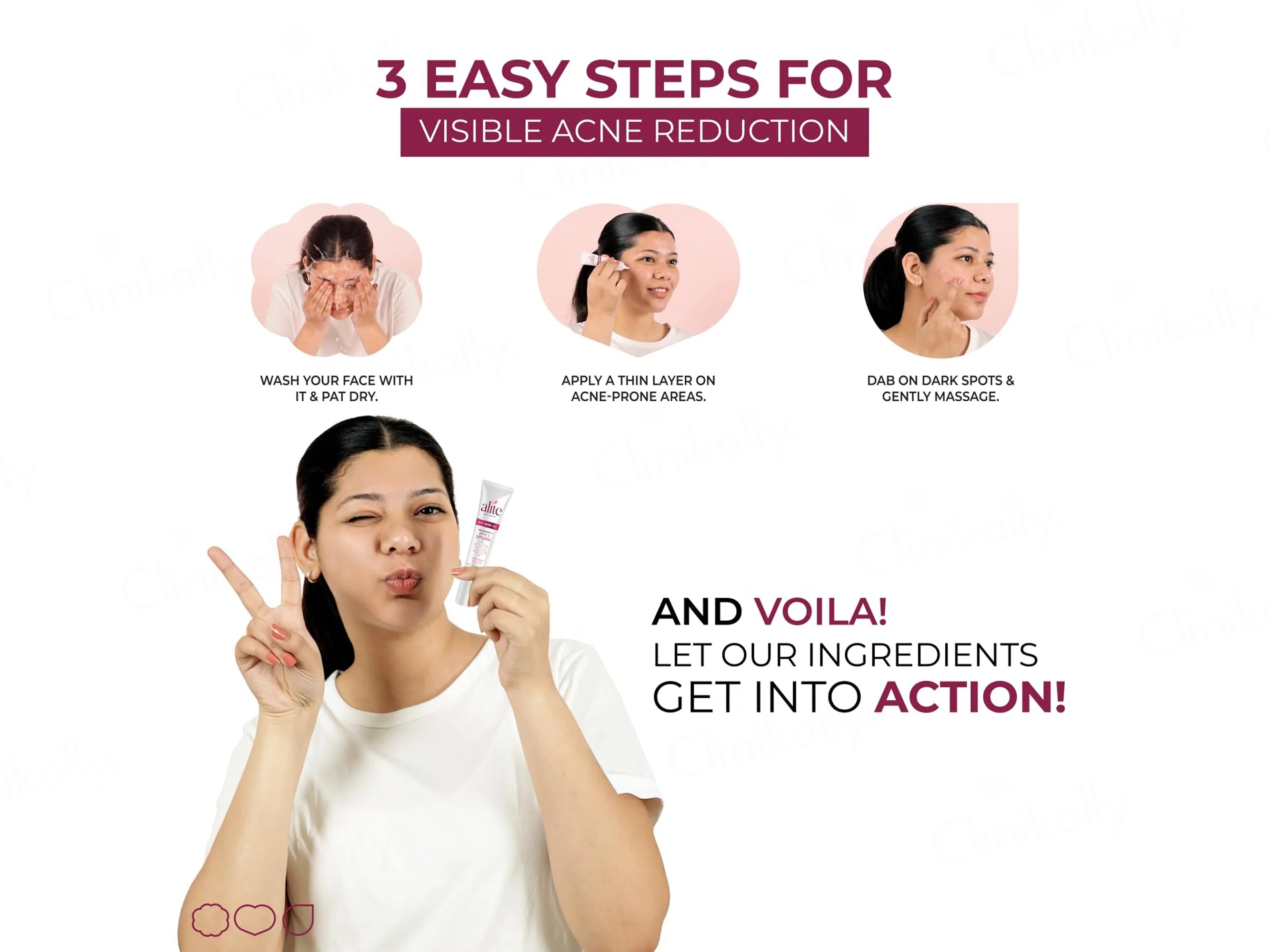 Alite Anti Acne Gel - Image 7