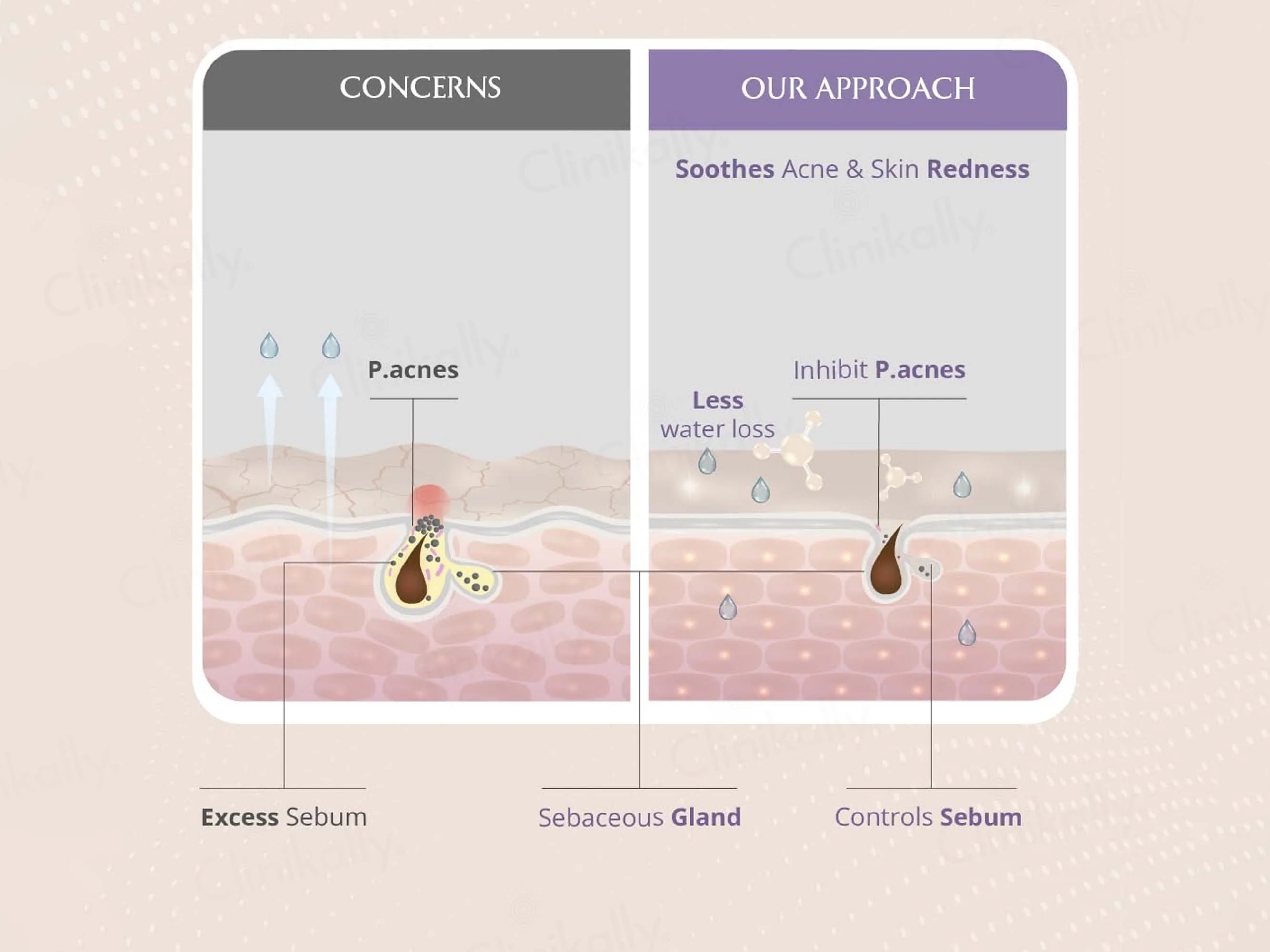 Areoveda Moisturising Baby Spray Lotion - Image 8