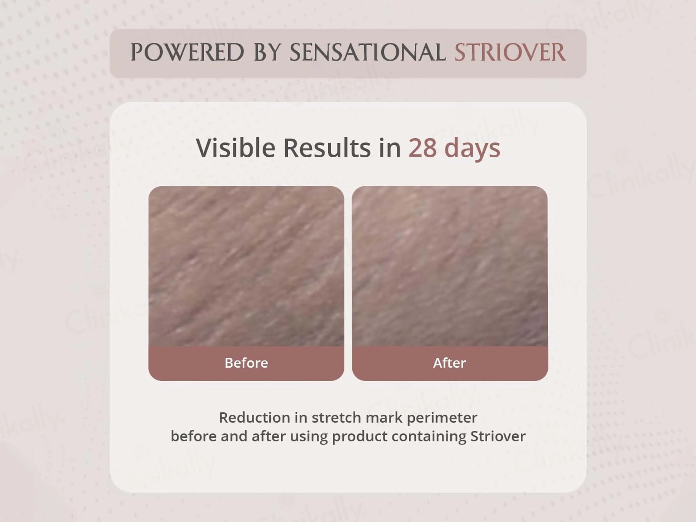 Areoveda Stretch Marks Cream - Image 7