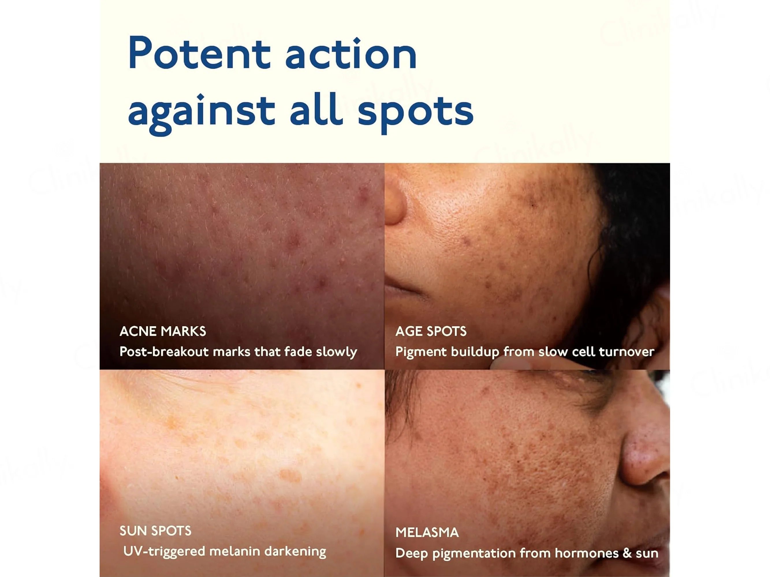 Asaya Advanced Spot Targeting Face Gel - Image 7