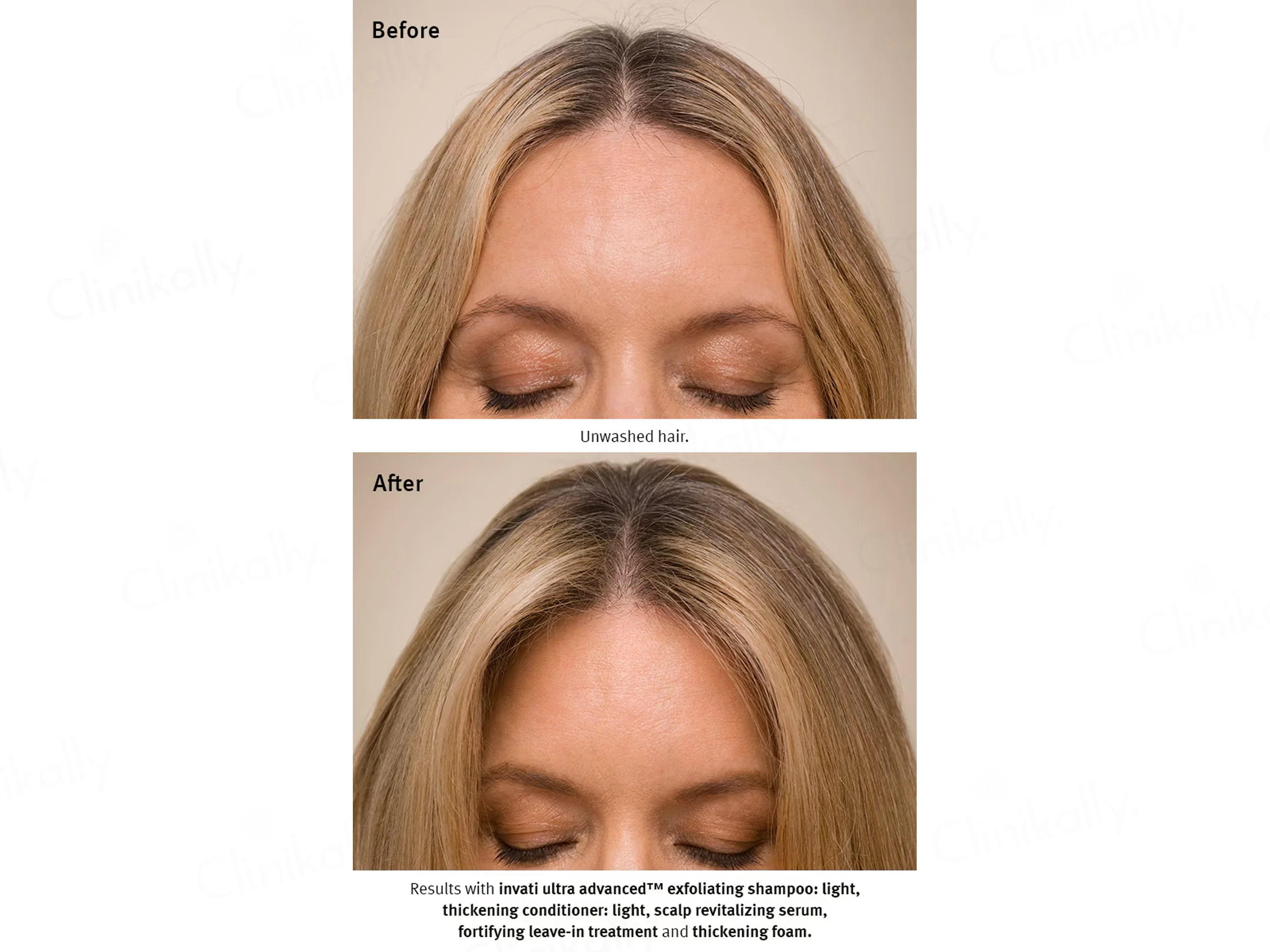 Aveda Invati Ultra Advanced Exfoliating Shampoo For Thinning Hair - Image 5