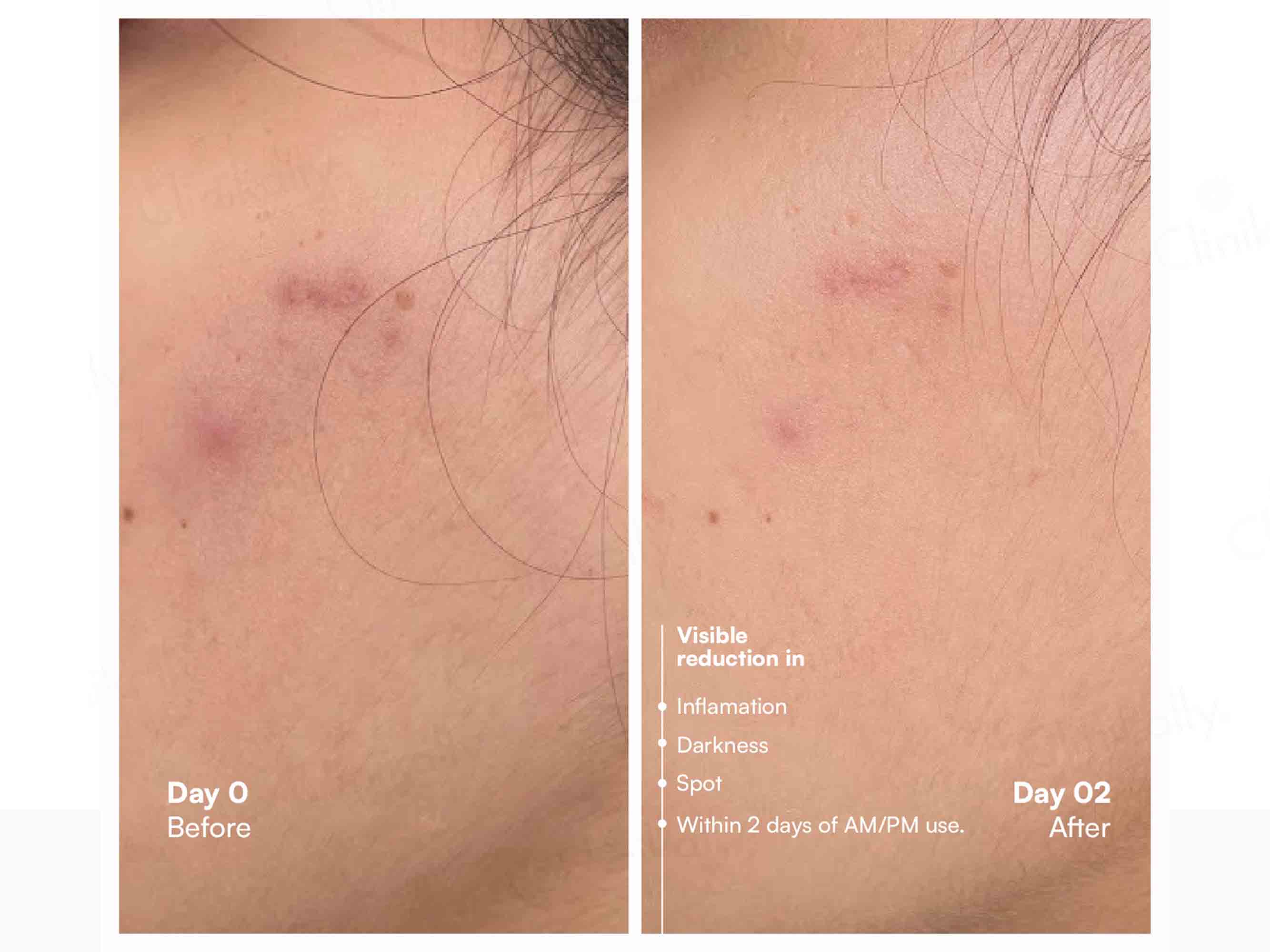 Awear Beauty Glass Skin Dual Spot Treatment Serum - Image 6
