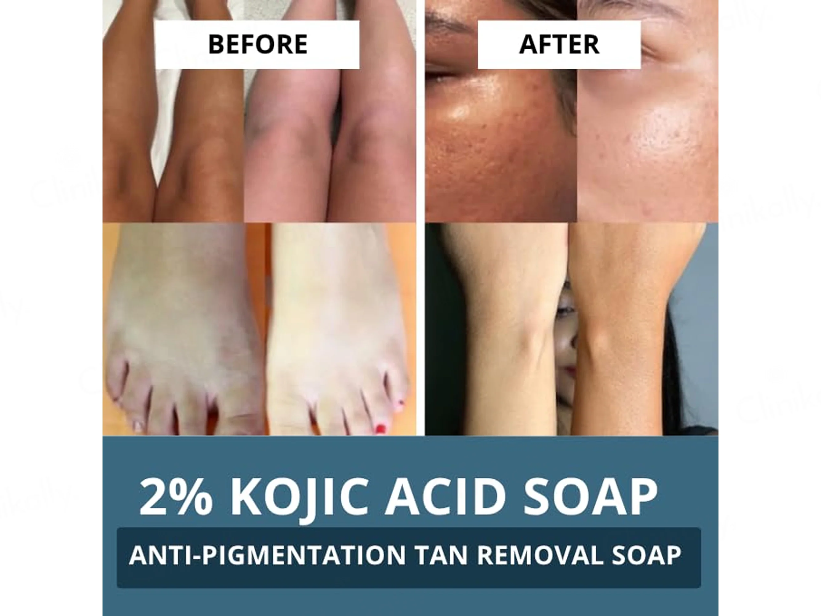 Bake 2% Kojic Acid + Alpha Arbutin Anti-Pigmentation Soap (Pack Of 2) - Image 3