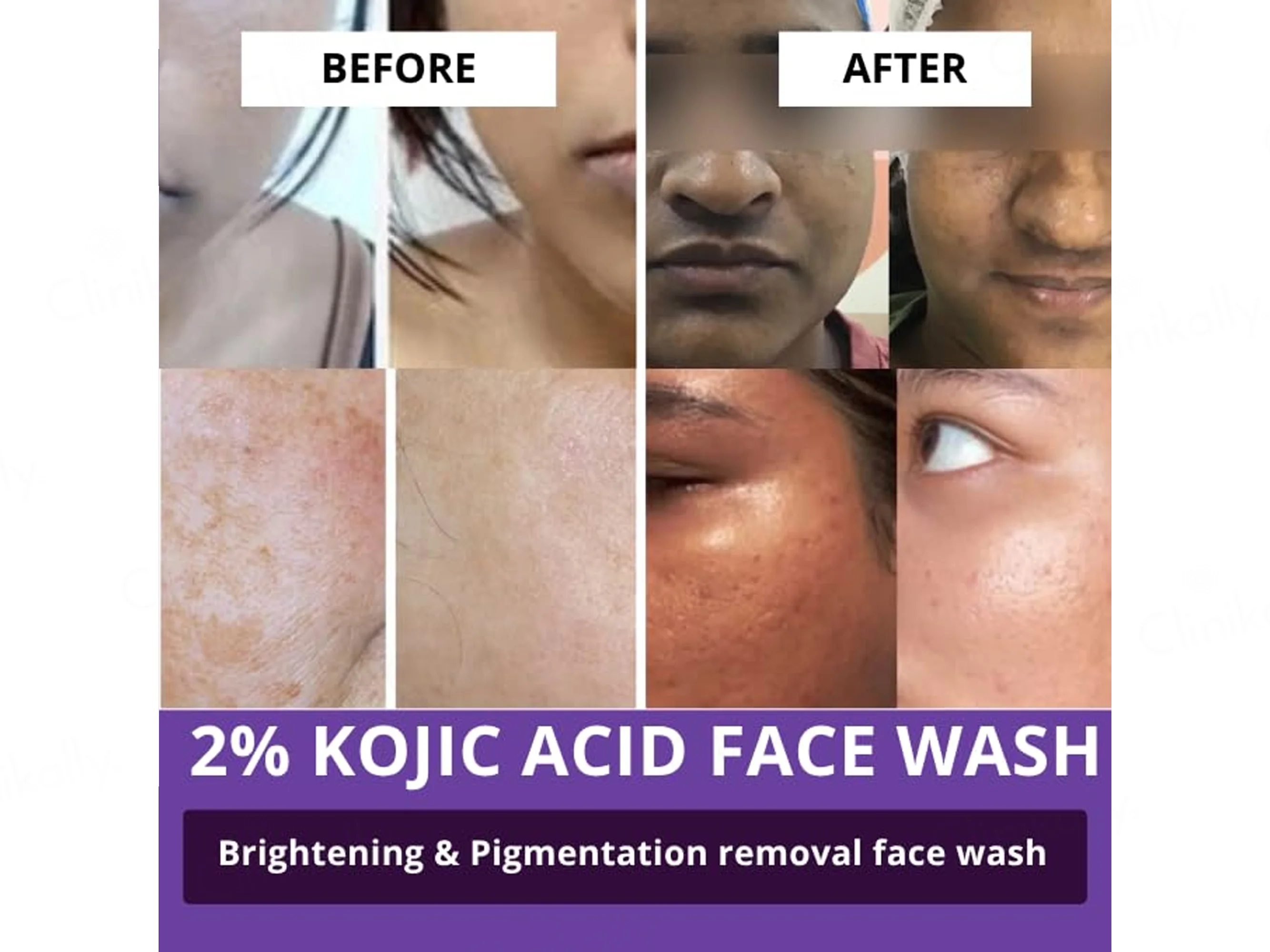 Bake 2% Kojic Acid + Alpha Arbutin Facewash - Image 4