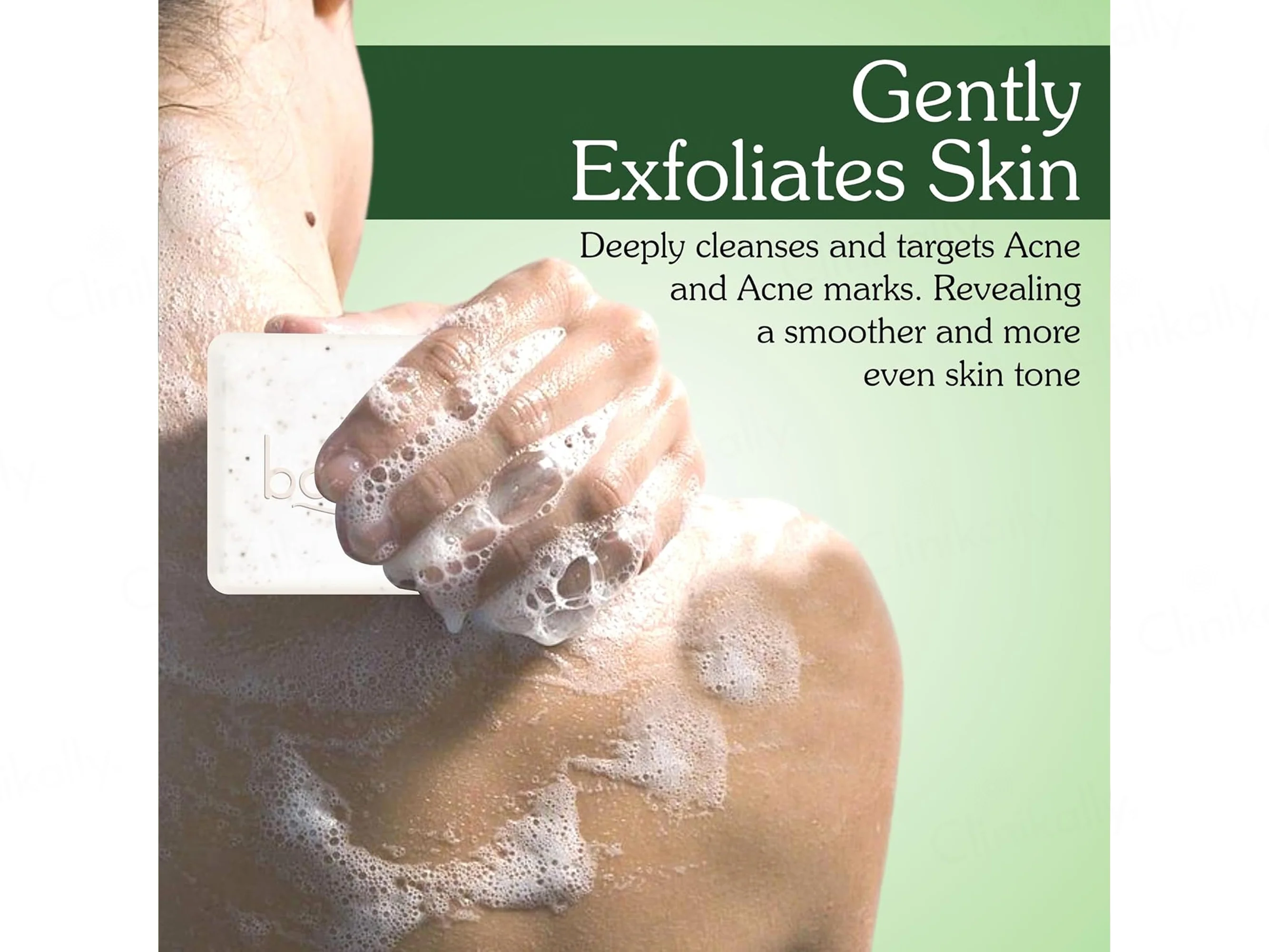 Bake 2% Salicylic Acid + Benzoyl Peroxide Body Acne Clearing Soap (Pack Of 2) - Image 4