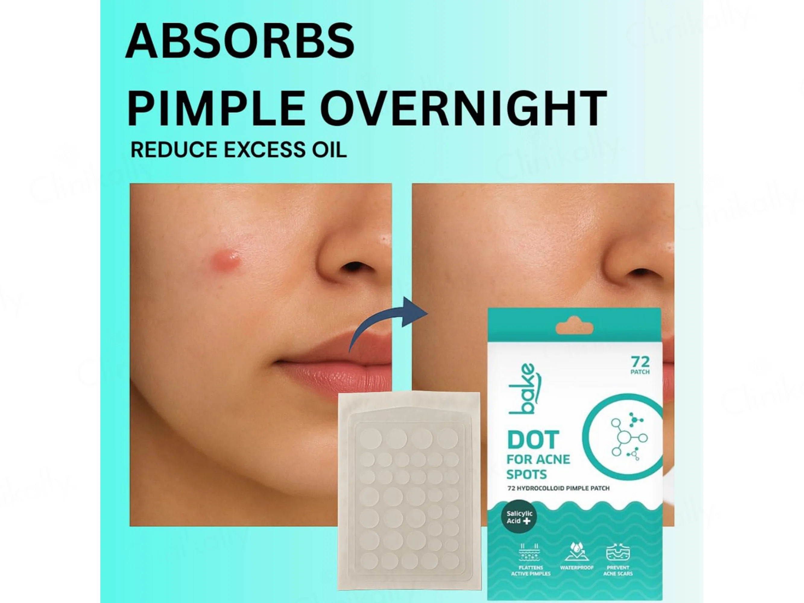 Bake Salicylic Acid Dot Acne Patch - Image 3