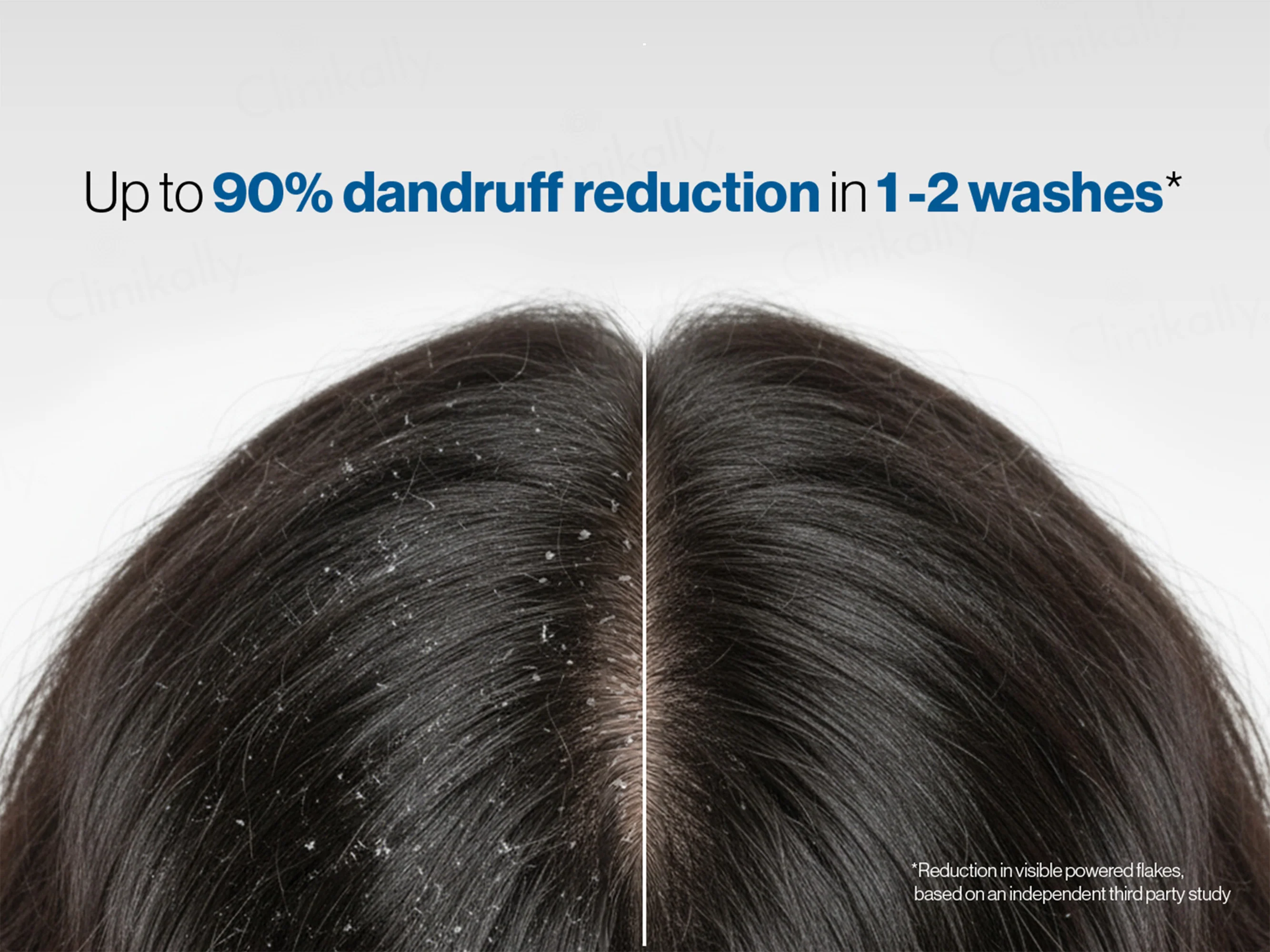 Be Bodywise 1% Ketoconazole Dandruff Shampoo - Image 4