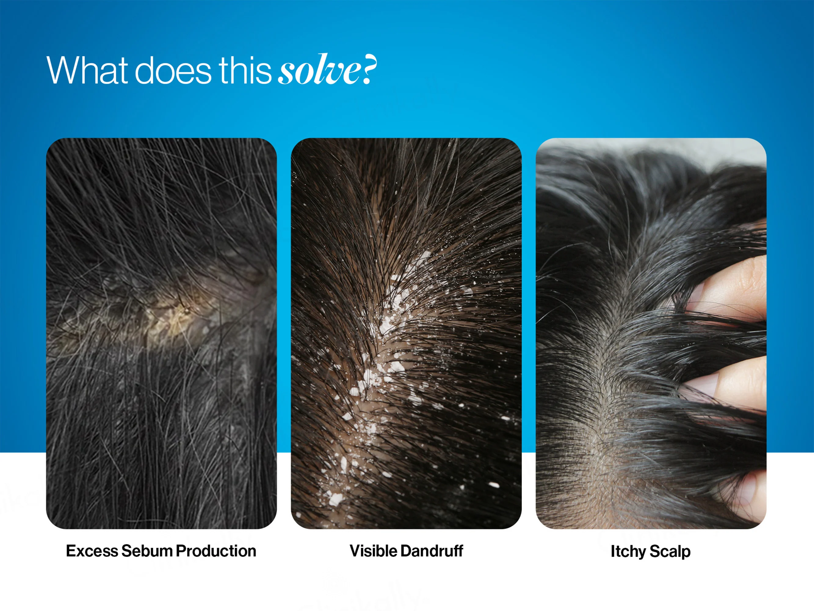 Be Bodywise 1% Ketoconazole Dandruff Shampoo - Image 5