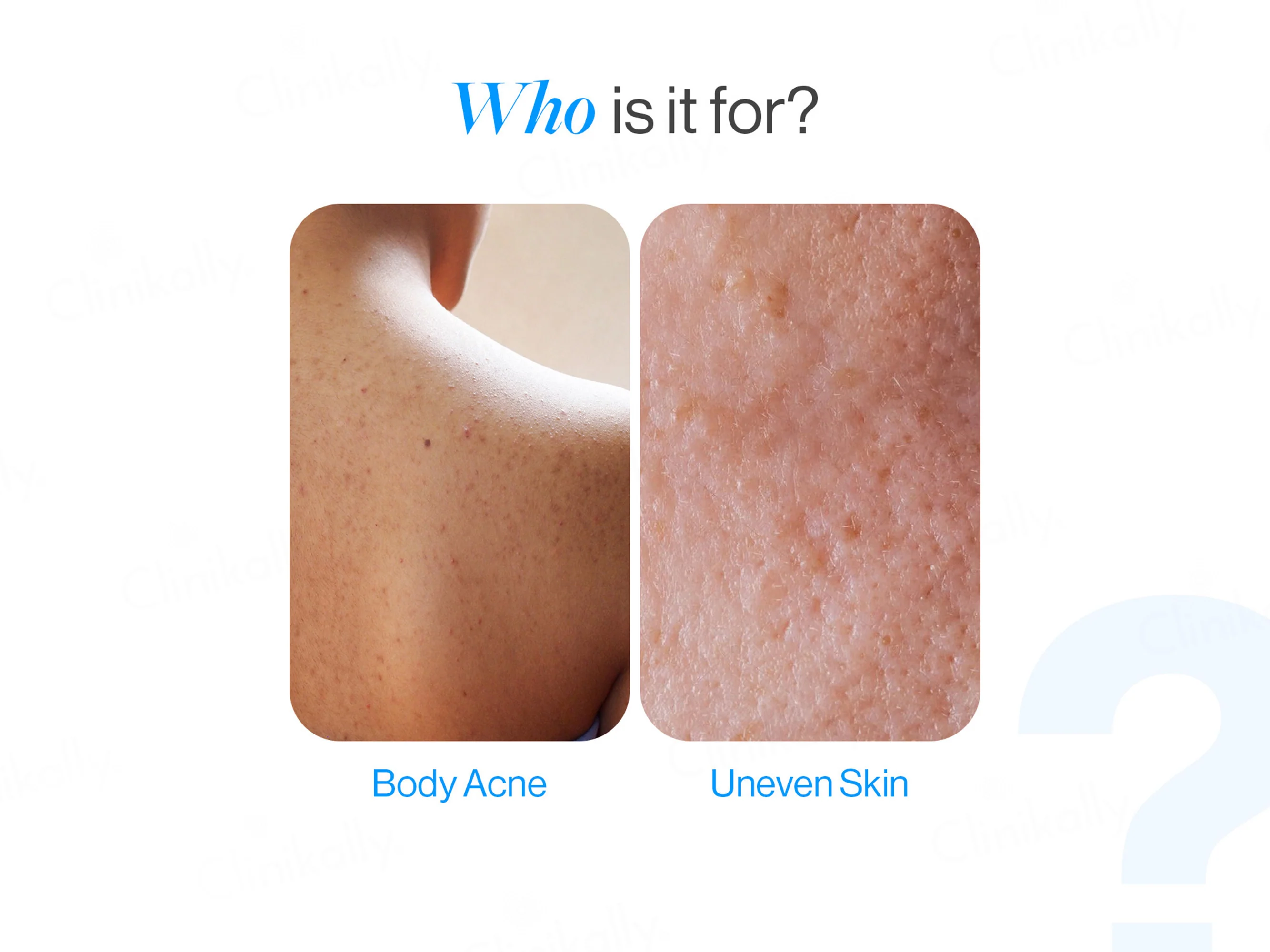 Be Bodywise 1% Salicylic Acid Body Wash - Image 4