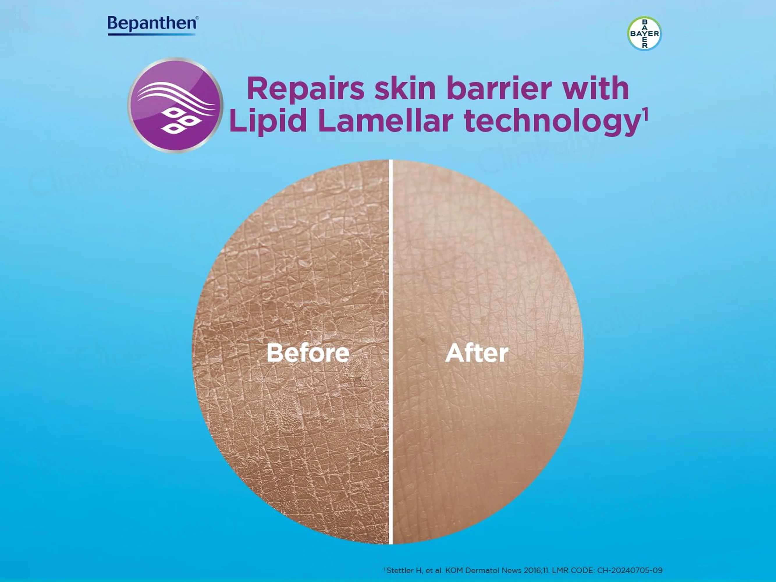 Bepanthen SensiCalm Steroid-Free Itch Relief Cream For Eczema-Prone Skin - Image 3