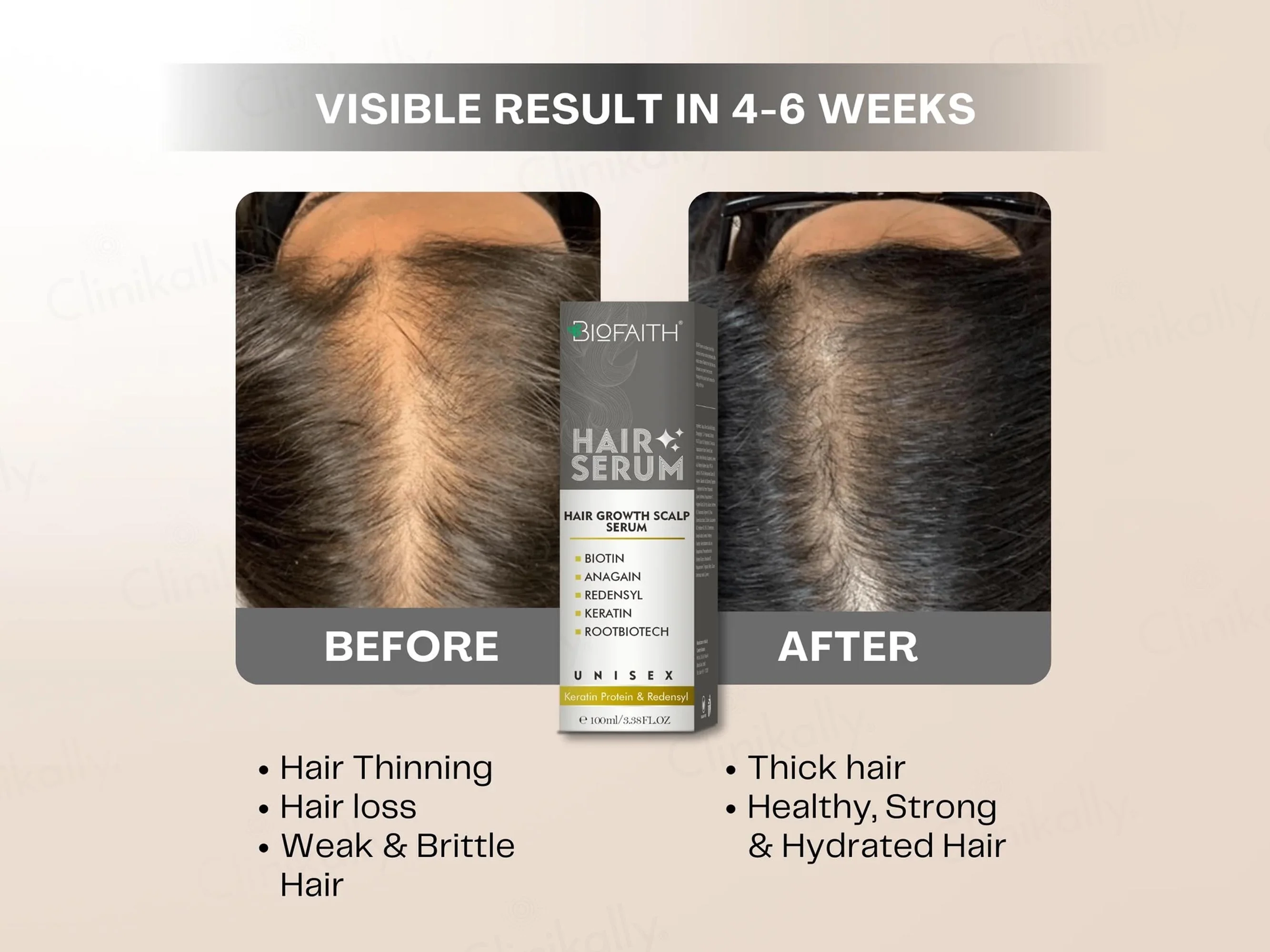 Biofaith Hair Regrowth Serum - Image 8