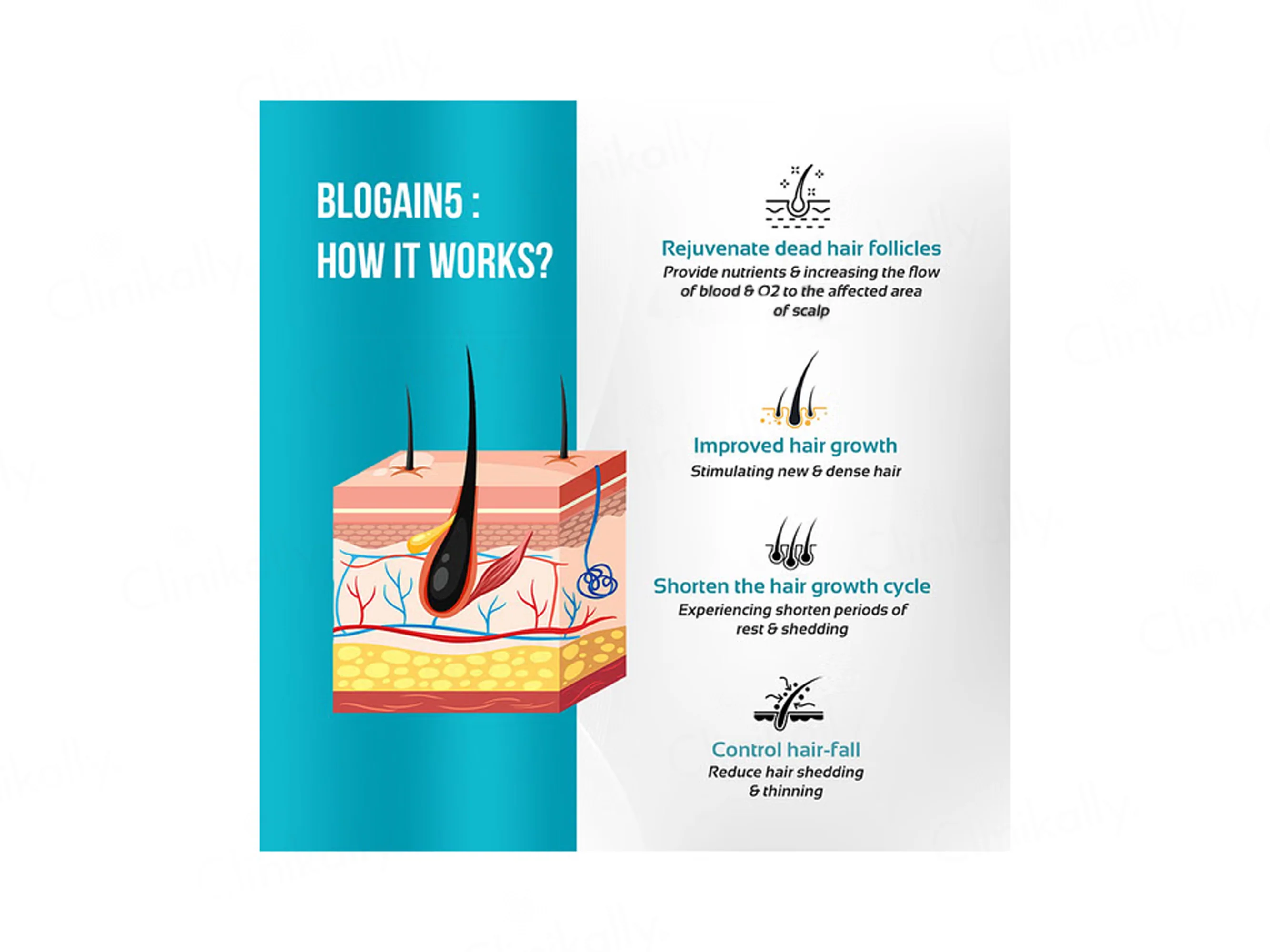 Blogain-5 Hair Growth Topical Solution - Image 3
