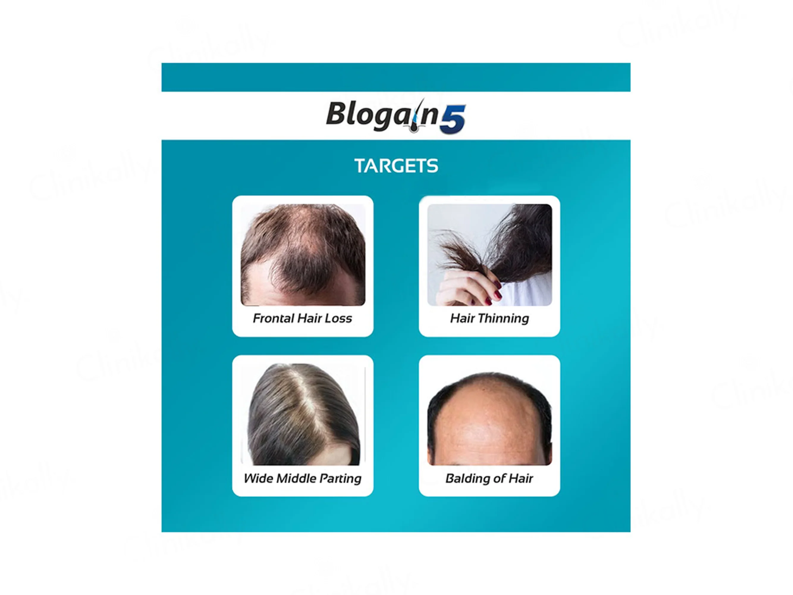 Blogain-5 Hair Growth Topical Solution - Image 4