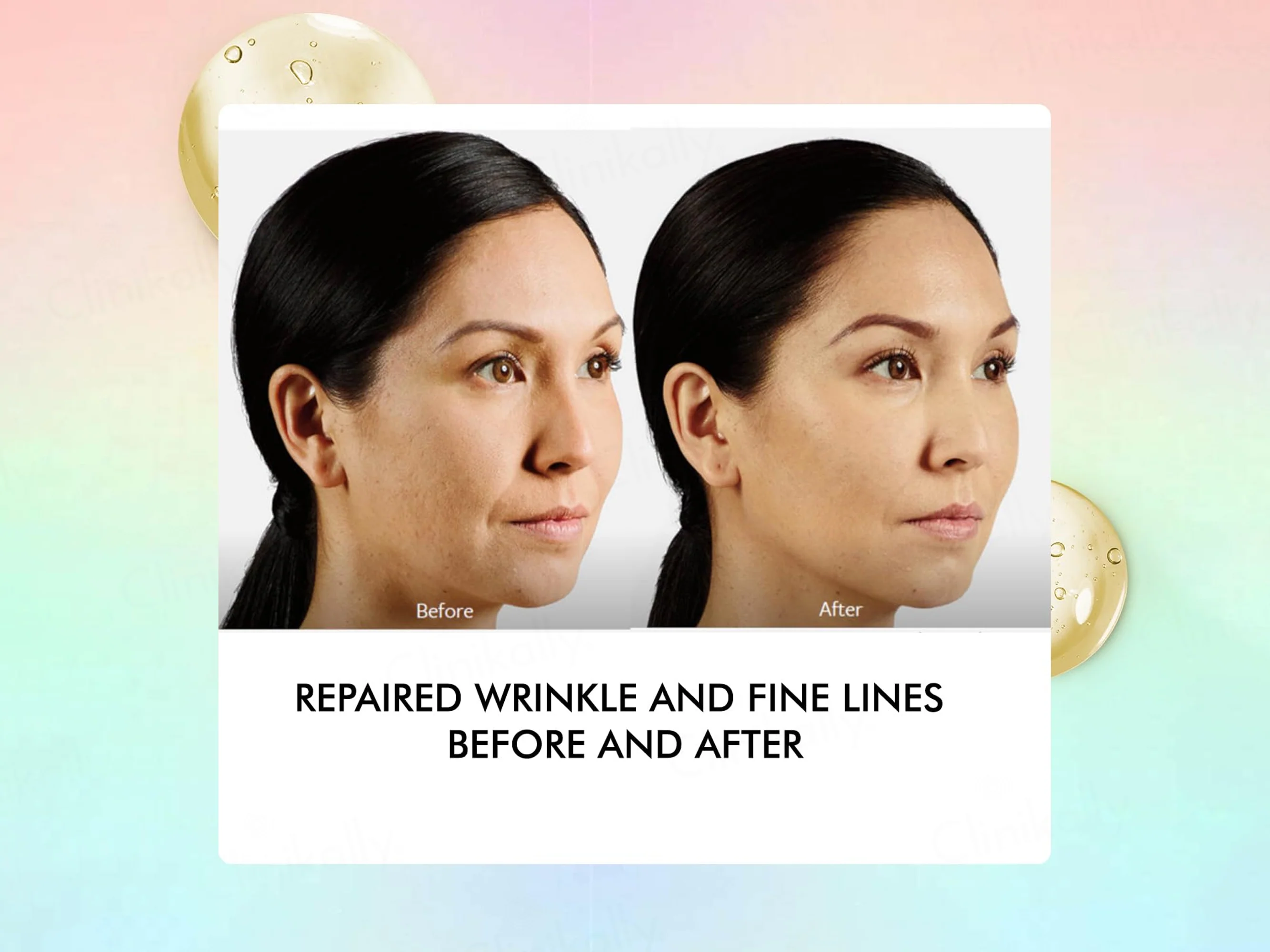 By Naked Fact Argireline + Squalene Anti Aging Serum - Image 3