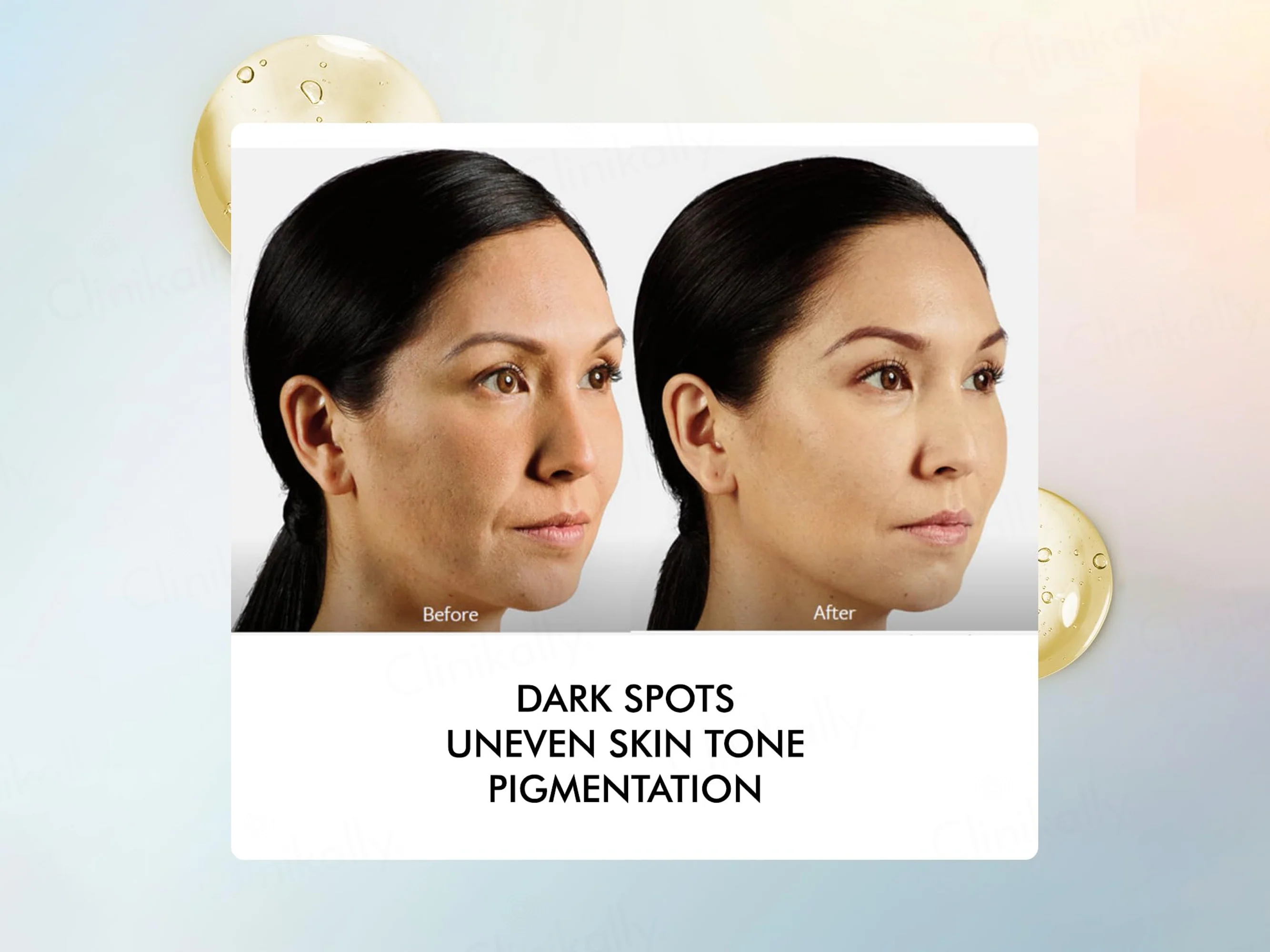 By Naked Fact Insta Care Vitamin C Serum - Image 4
