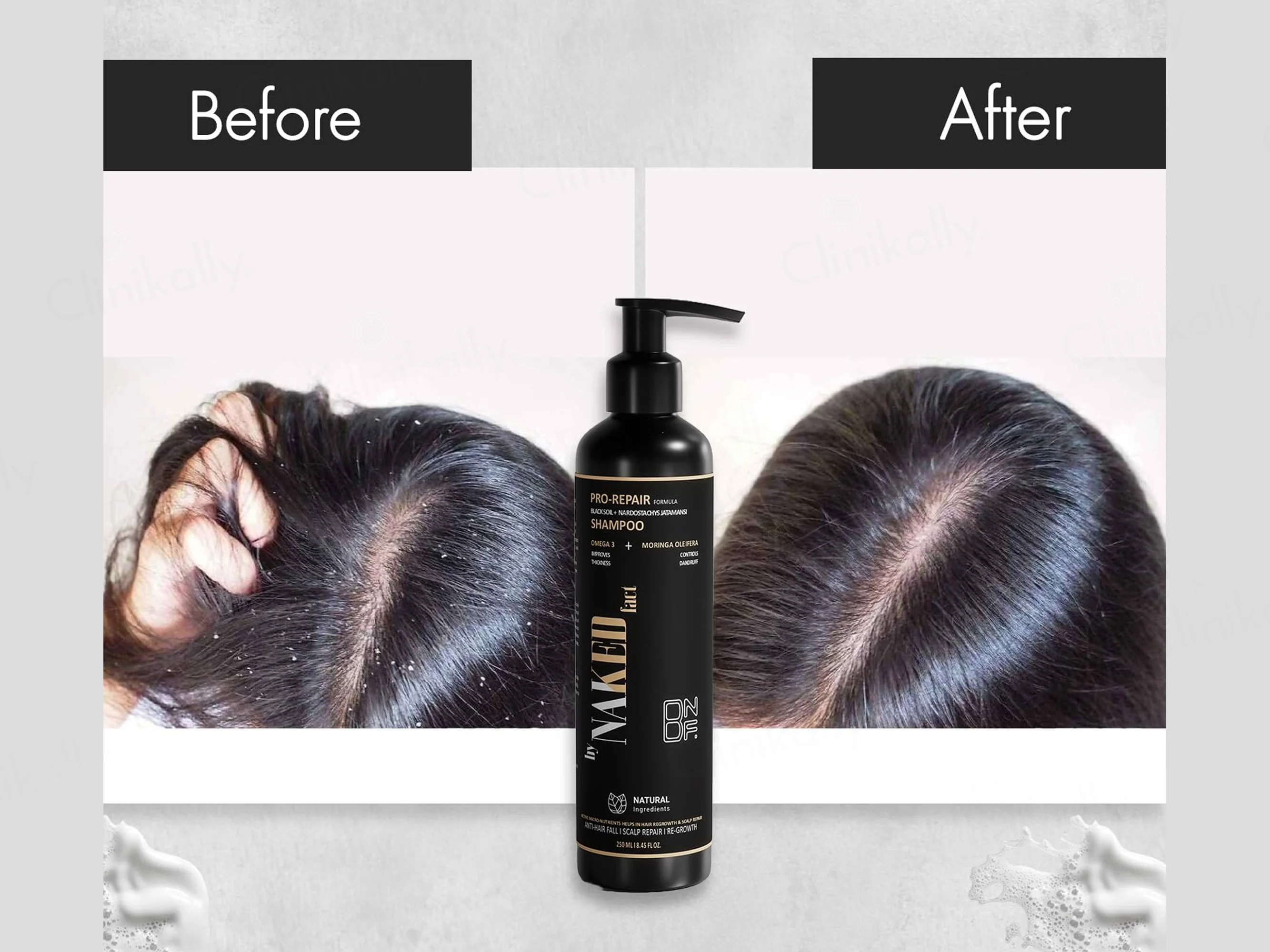 By Naked Fact Pro Repair Black Soil + Nardostachys Jatamansi Anti-Hairfall Shampoo - Image 5