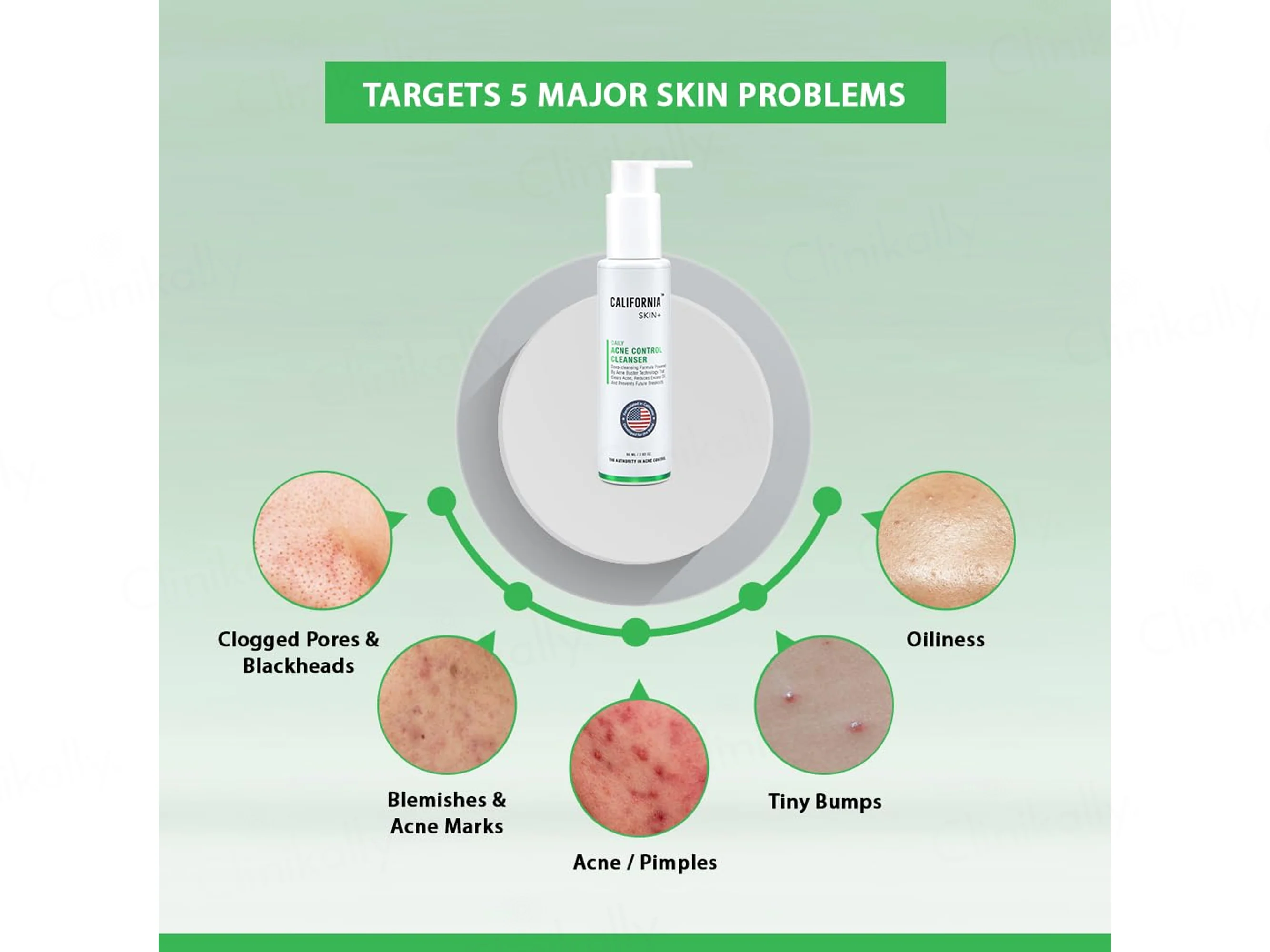 California Skin+ Acne Control Cleanser - Image 6