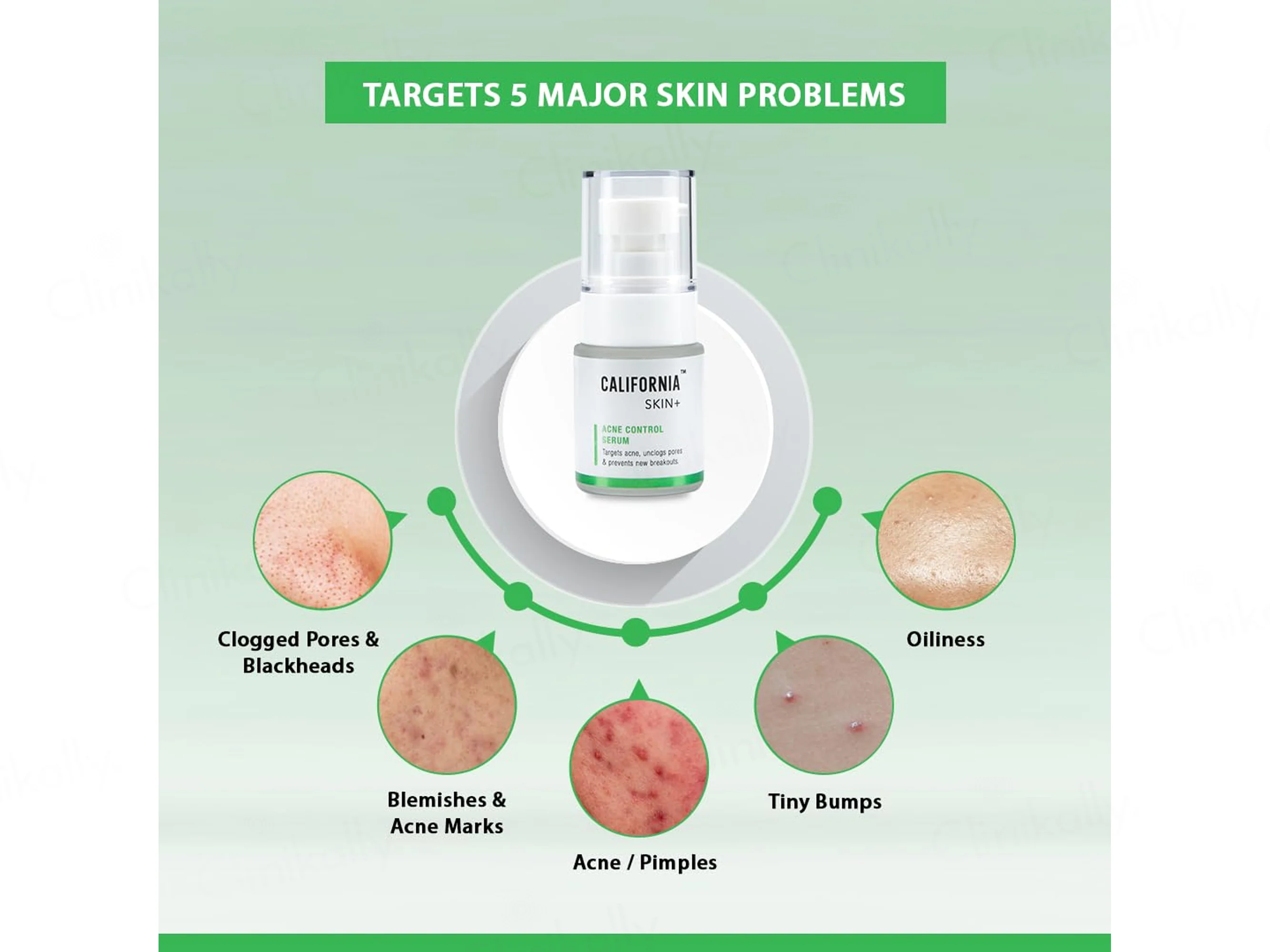 California Skin+ Acne Control Serum - Image 6
