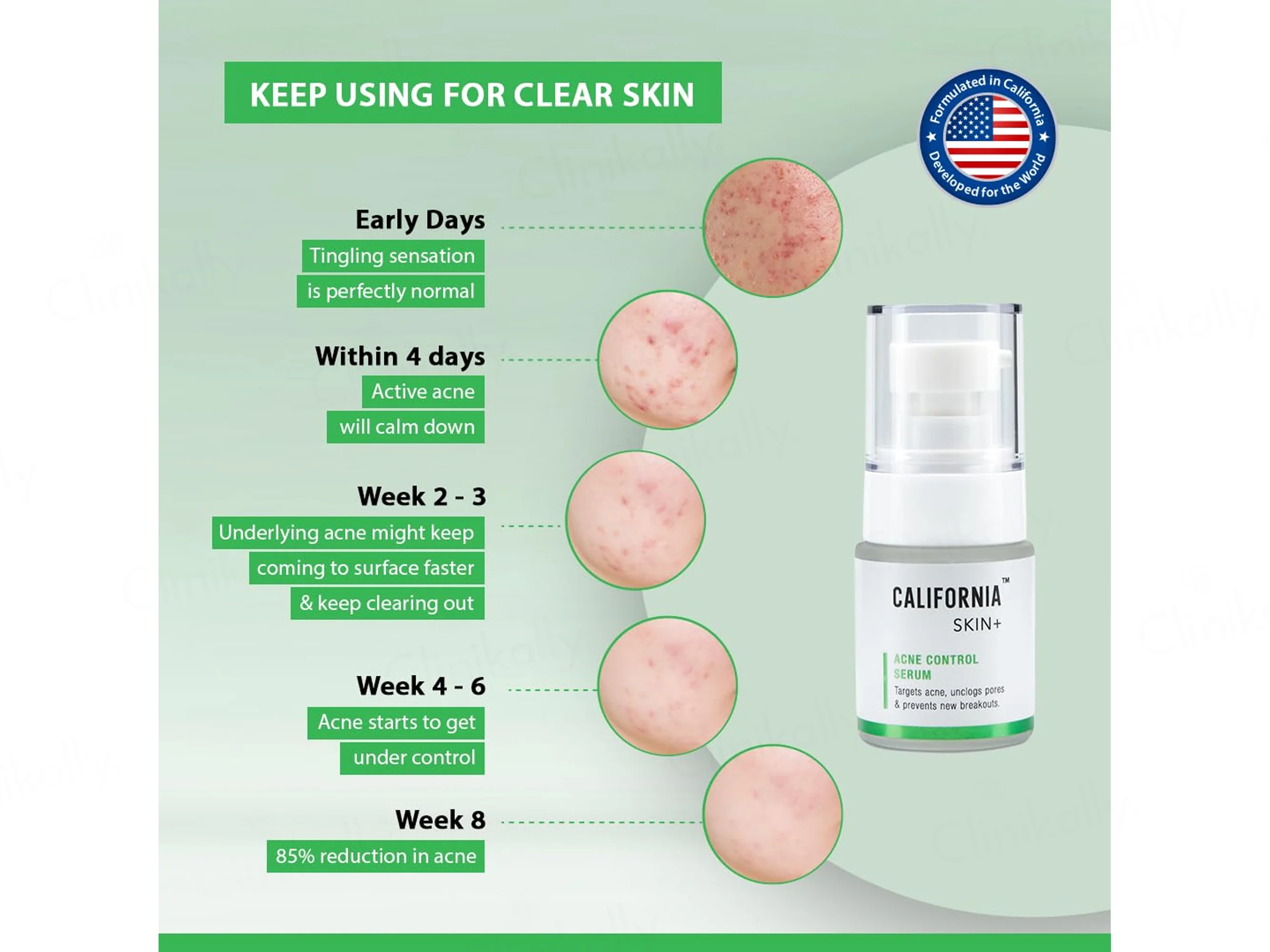 California Skin+ Acne Control Serum - Image 7