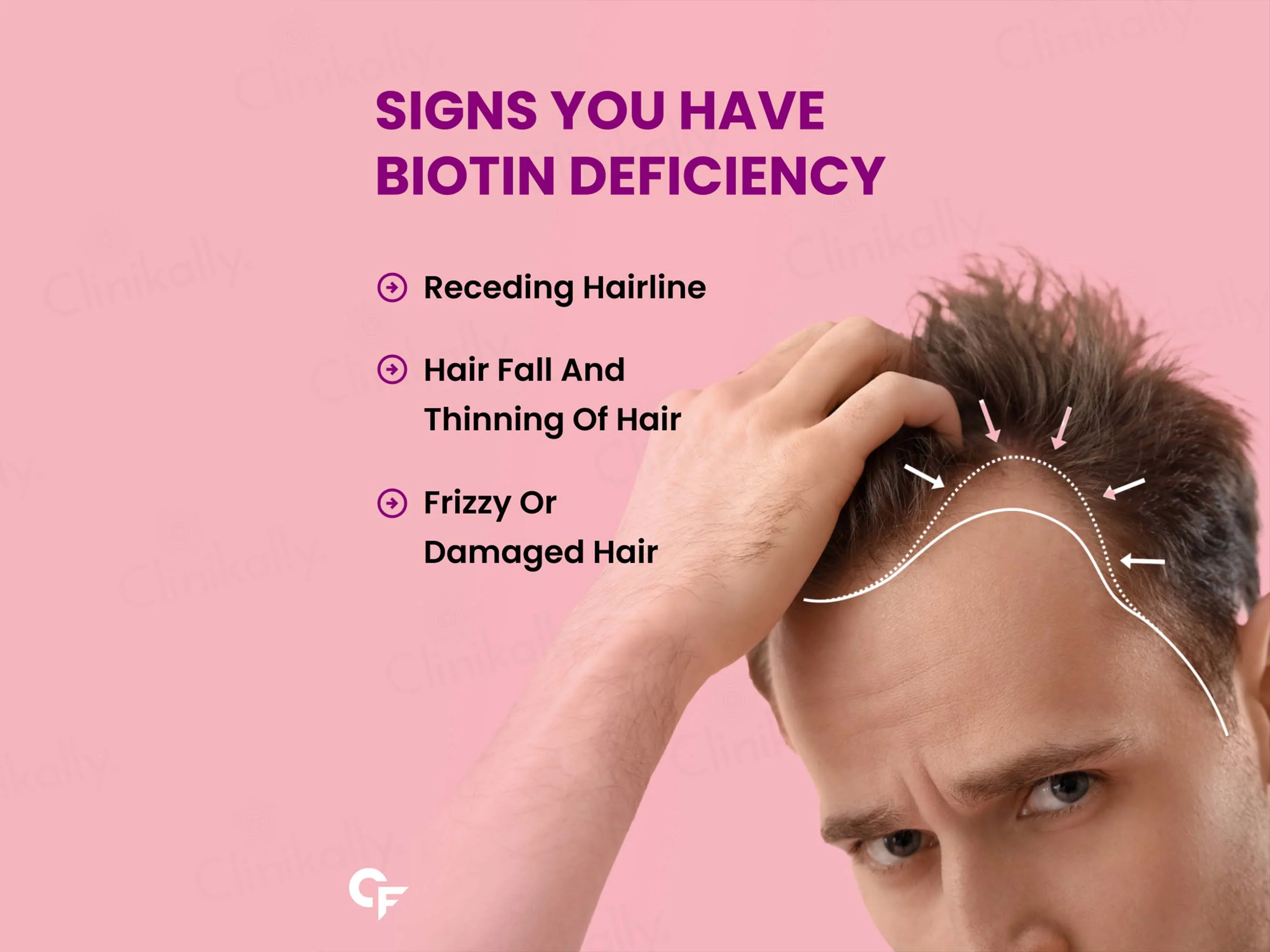 Carbamide Forte Biotin 10000mcg Tablet - Image 5