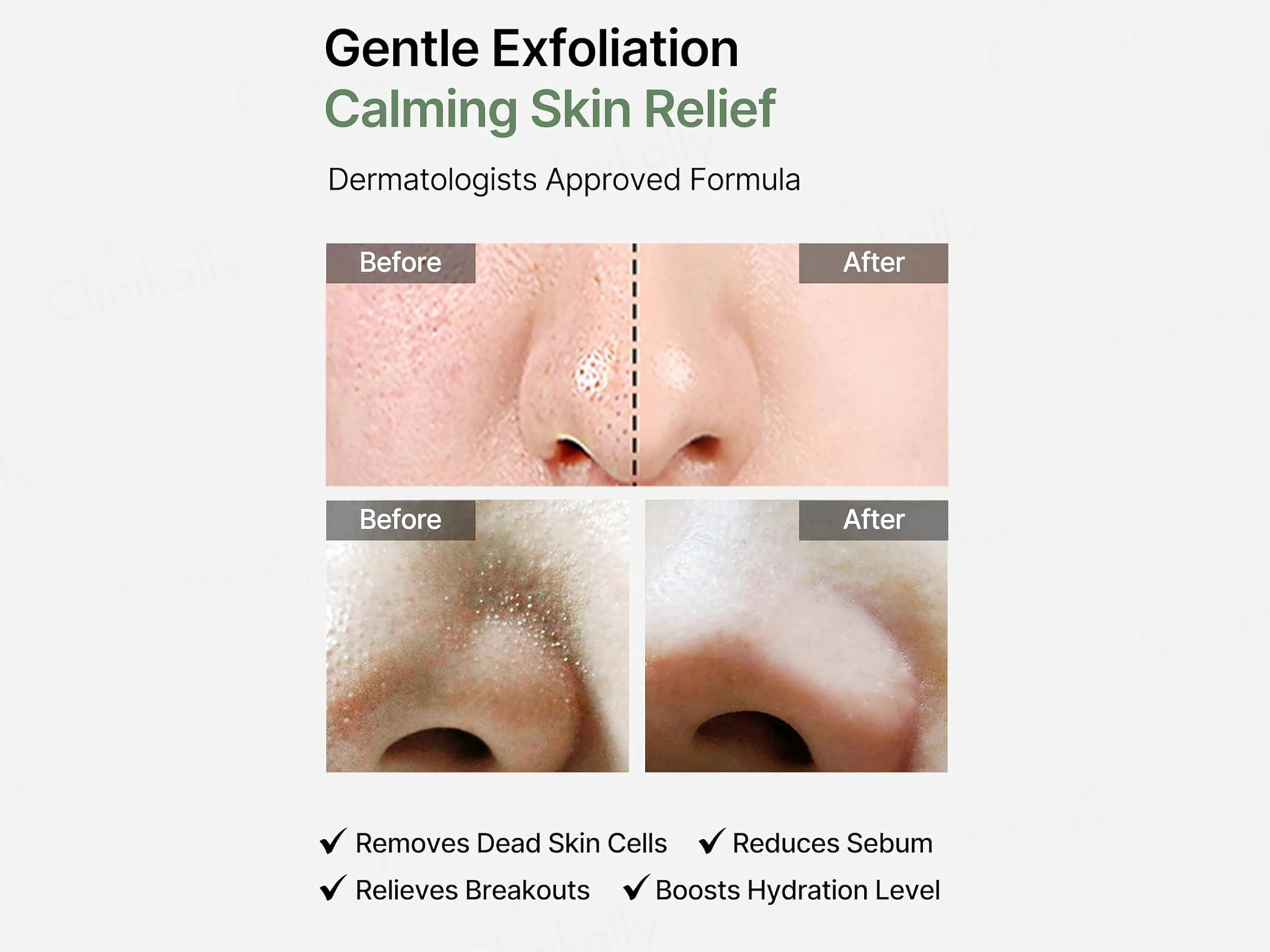 Celimax Ji Woo Gae Heartleaf BHA Peeling Pads - Image 3
