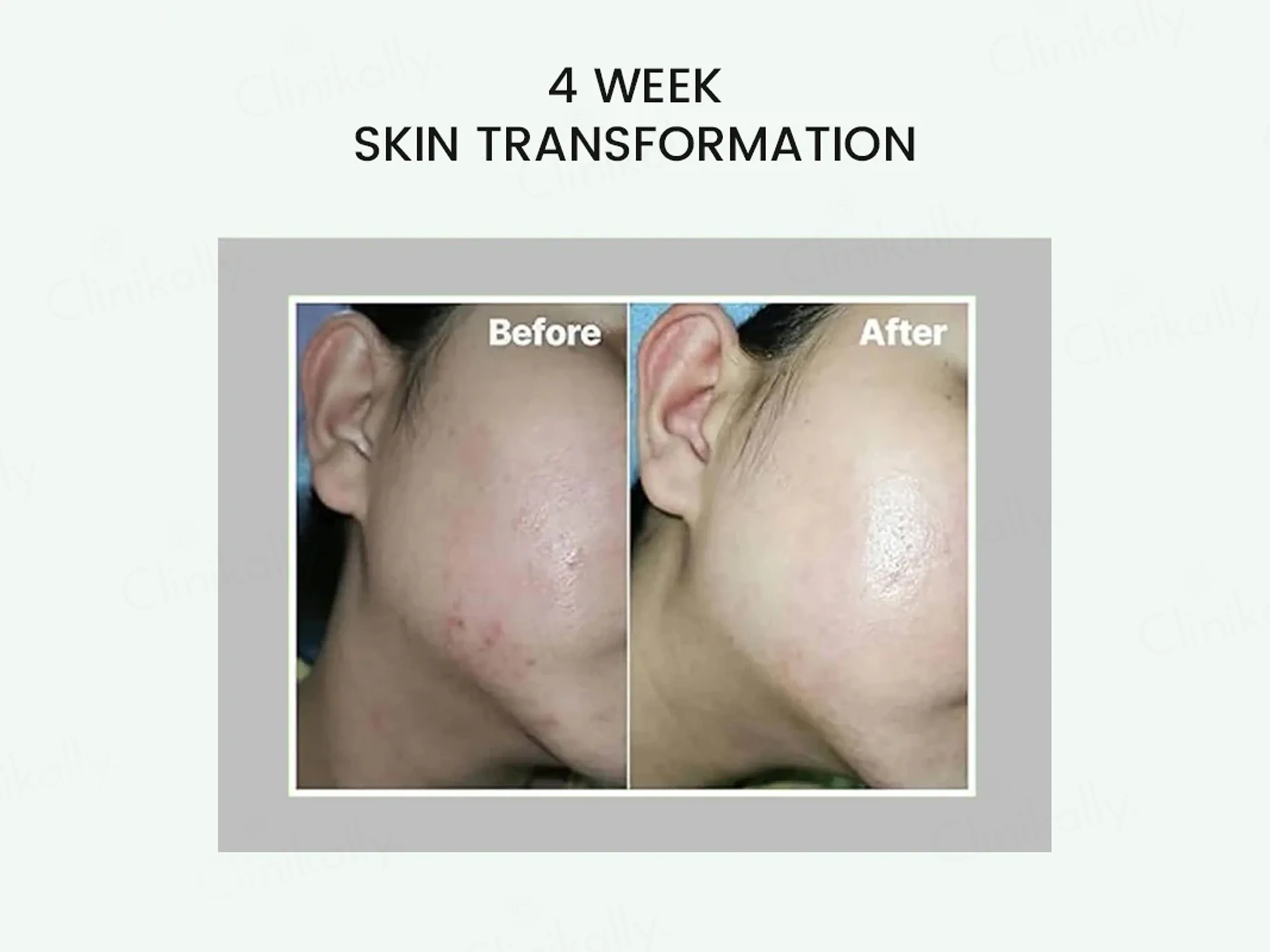 Celimax The Real Noni Energy Ampoule - Image 7