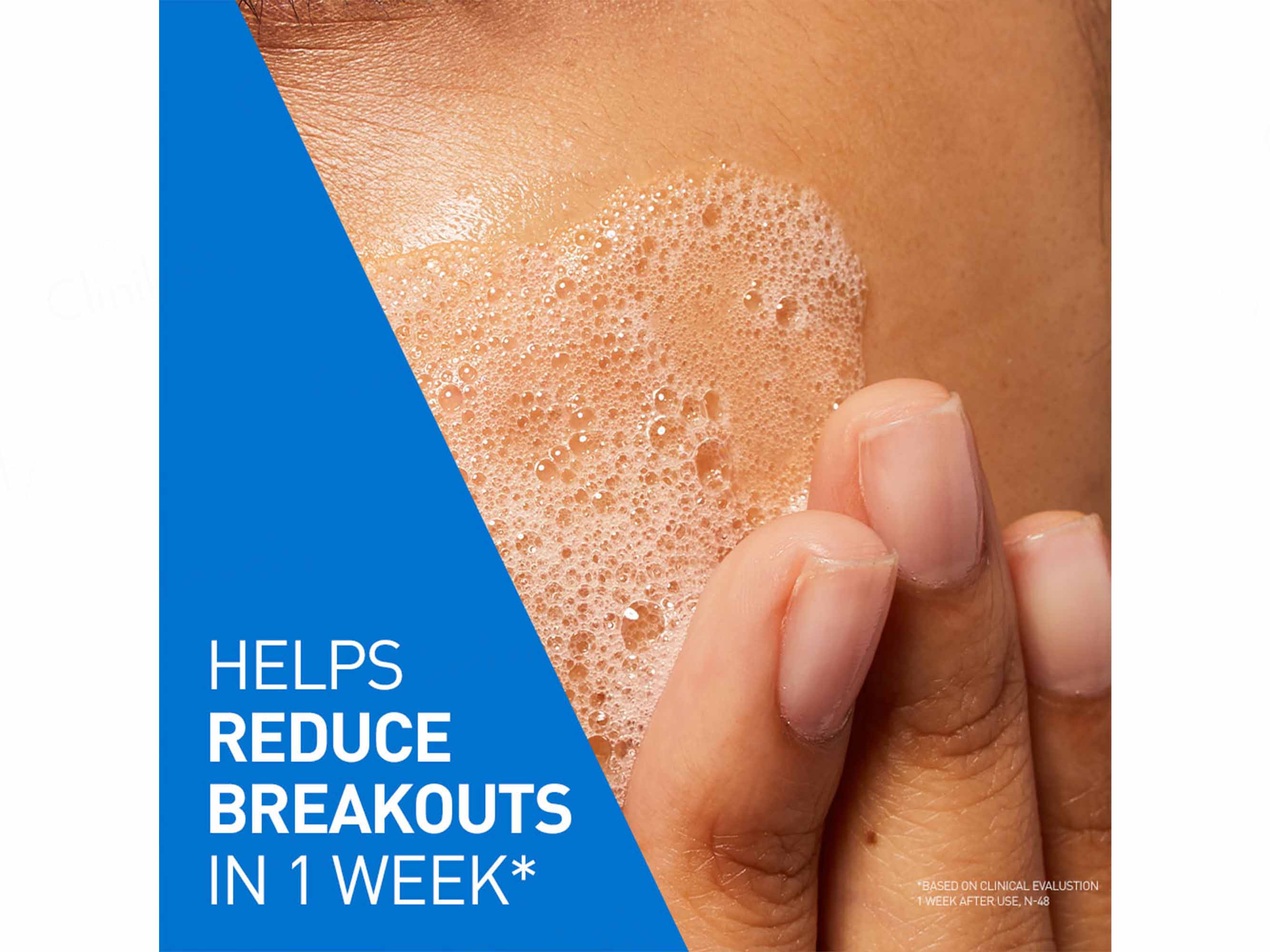CeraVe Blemish Control Cleanser For Blemish-Prone Skin - Image 4