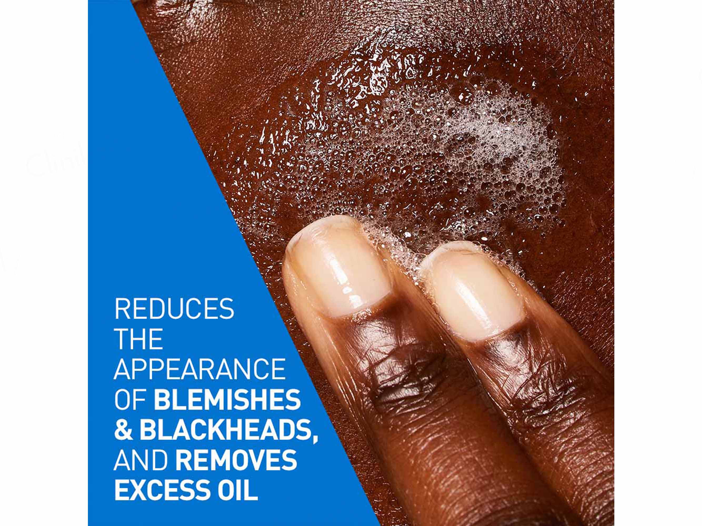 CeraVe Blemish Control Cleanser For Blemish-Prone Skin - Image 6