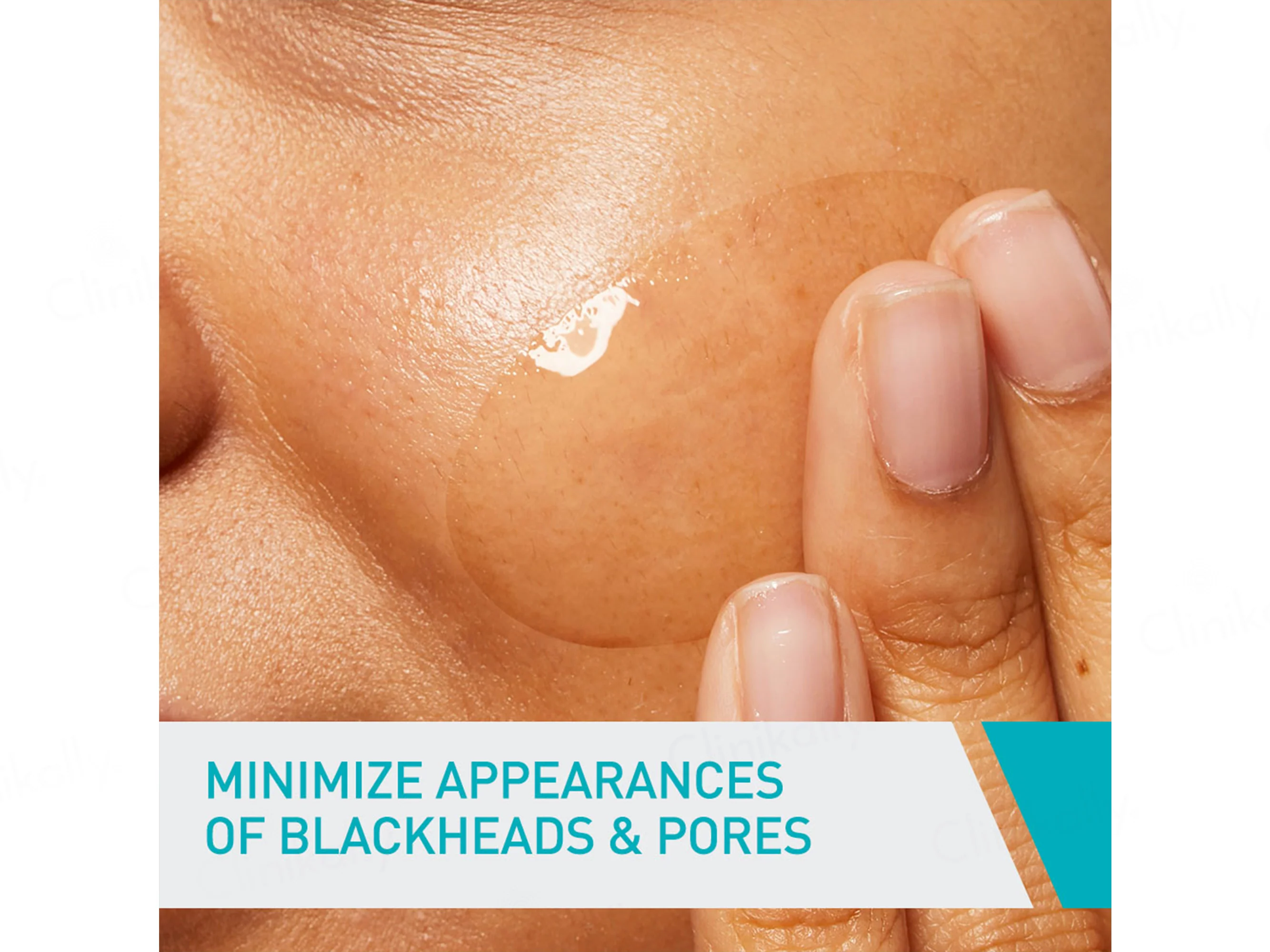 CeraVe Blemish Control Gel With AHA & BHA - Image 5