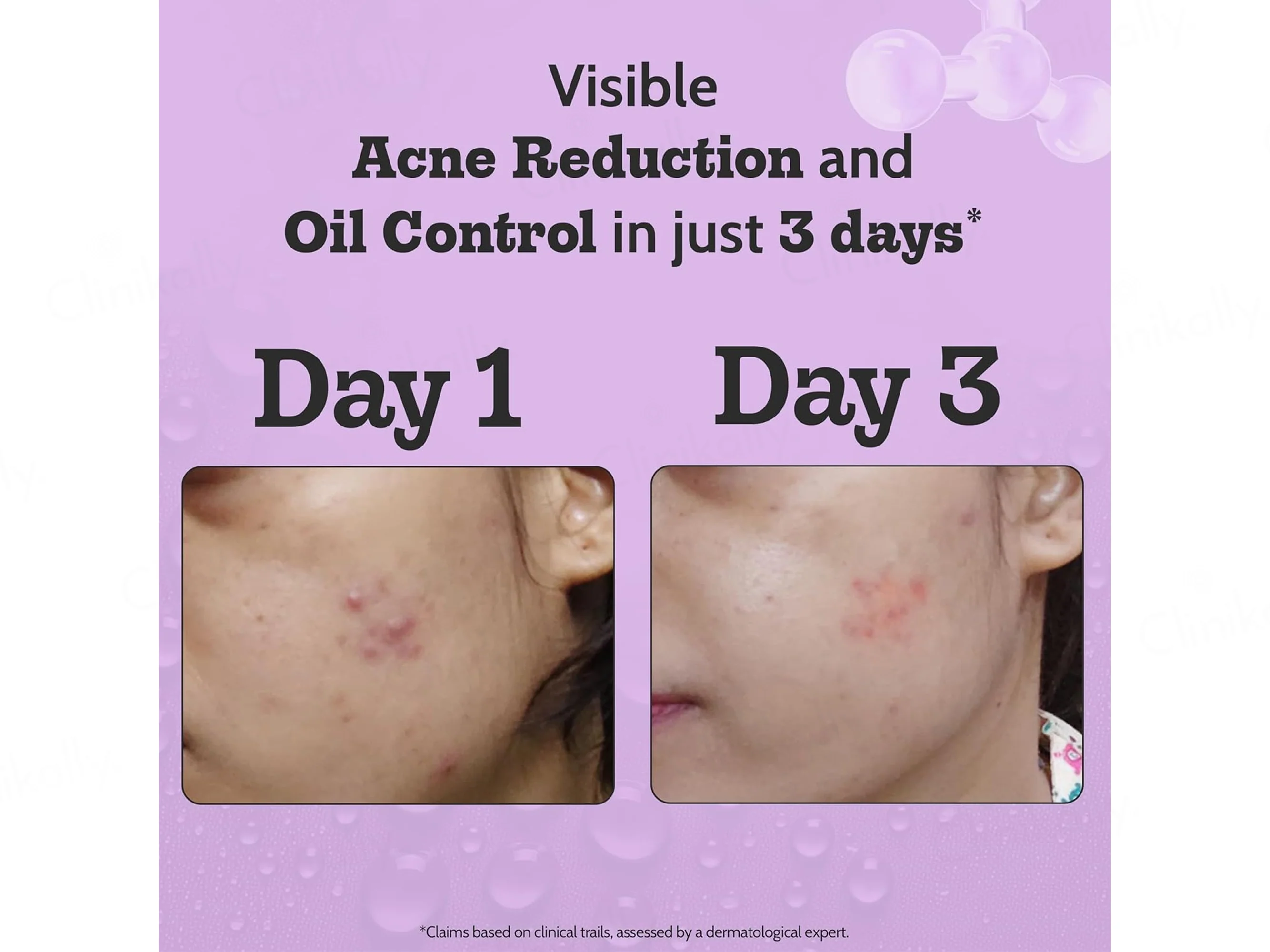 Chemist At Play 2% Salicylic Acid Acne Control Face Serum - Image 3