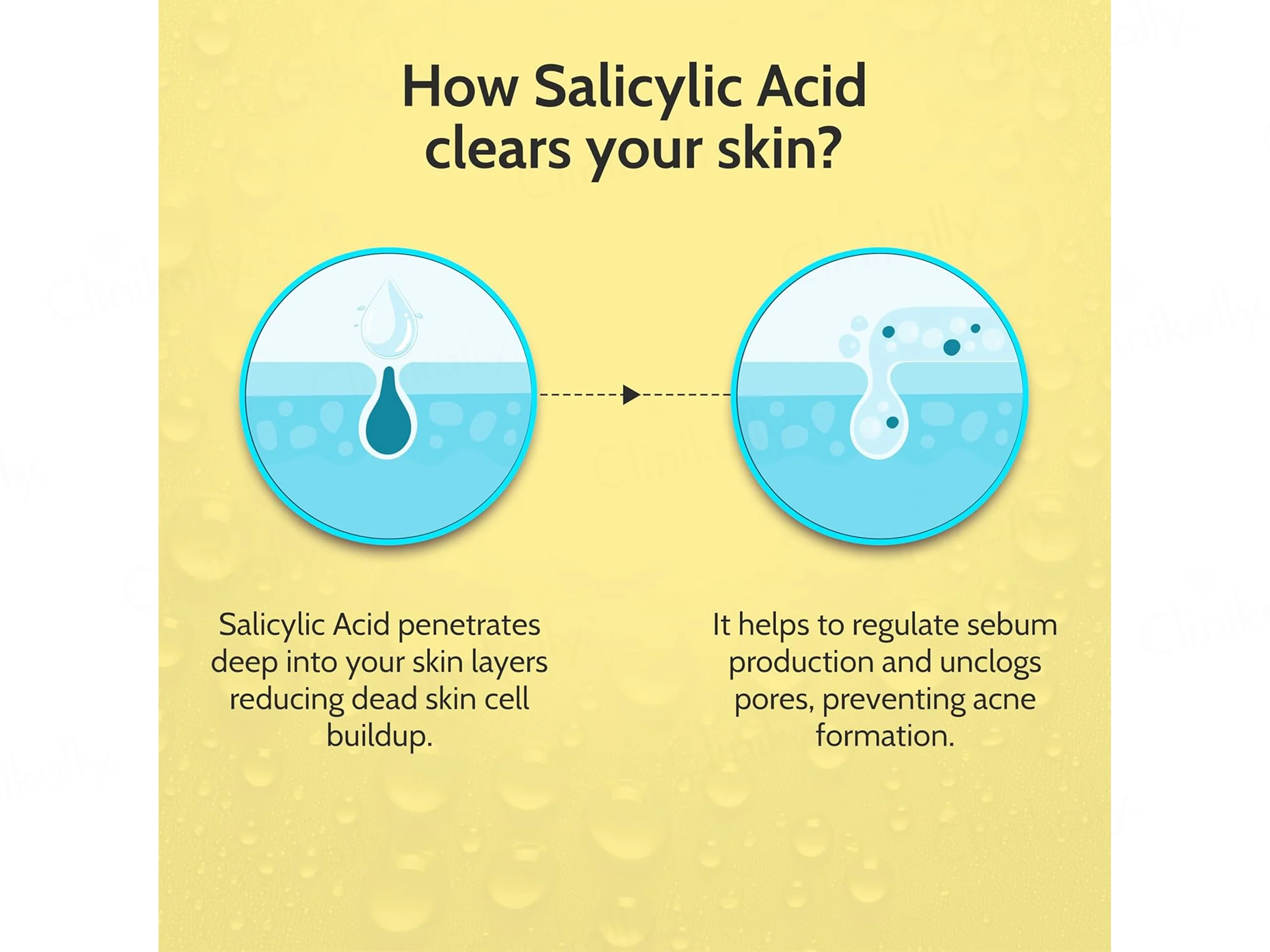 Chemist At Play 2% Salicylic Acid Acne Control Face Serum - Image 6