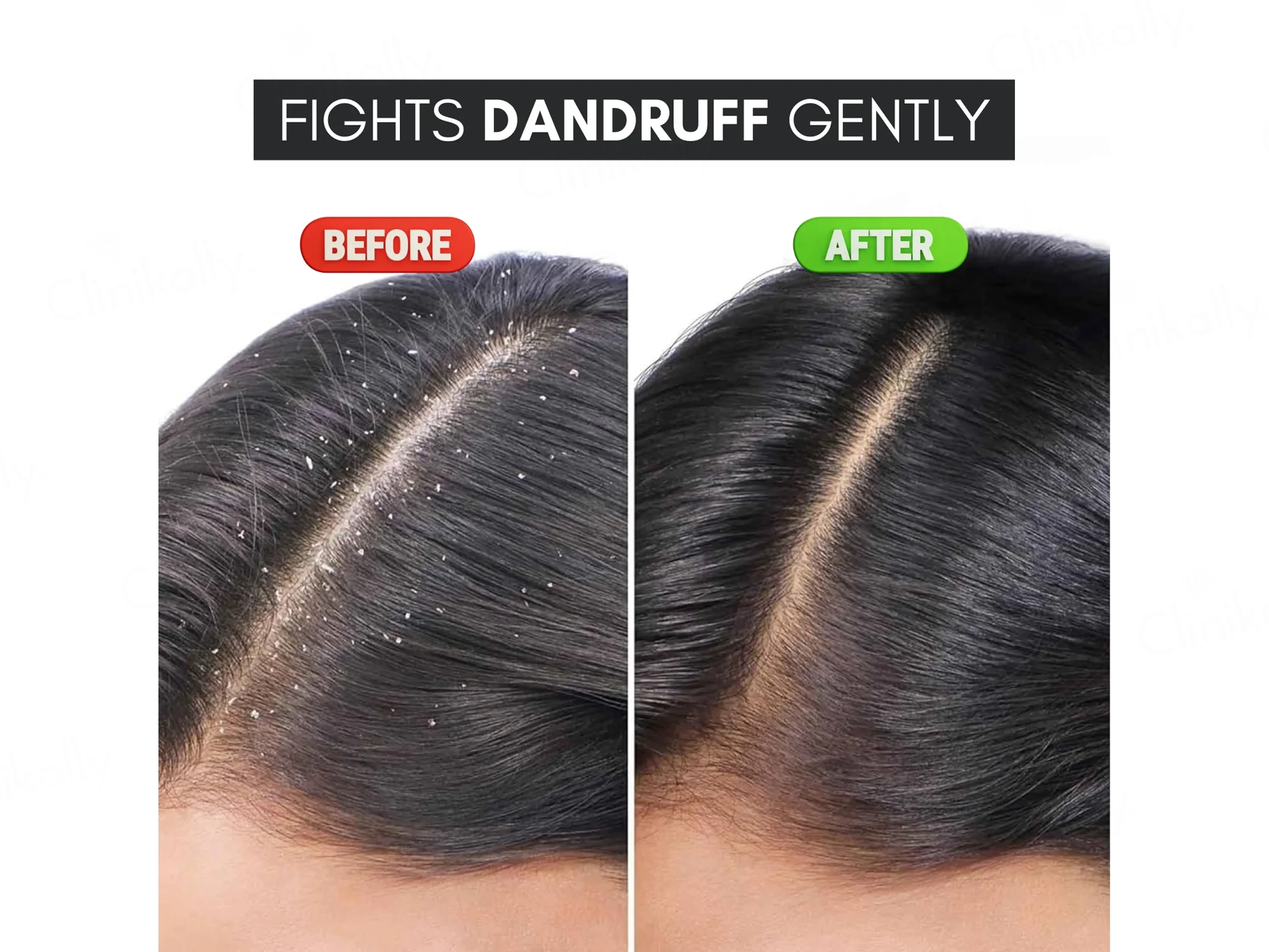 Climdruff Anti Dandruff Shampoo - Image 8