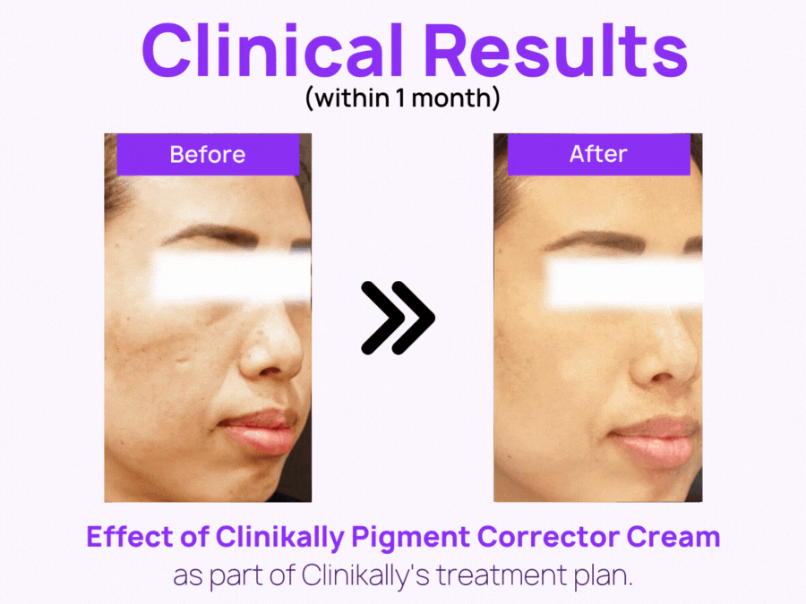 Clinikally The Ultimate NIA Serum + Pigment Corrector Cream - Image 2