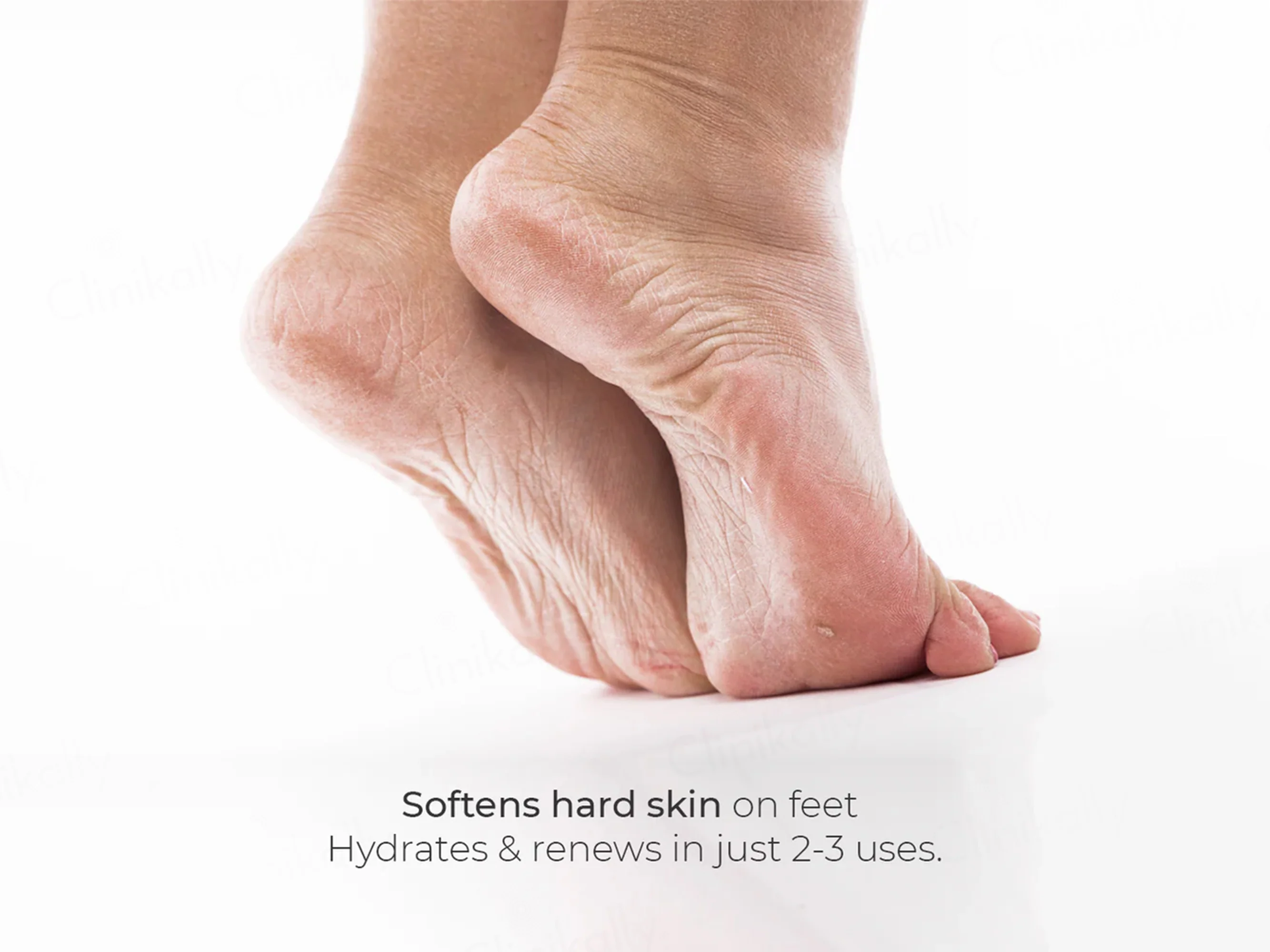 CodeSkin Velvet Foot Skin Softening Cream For Dry & Cracked Feet - Image 2