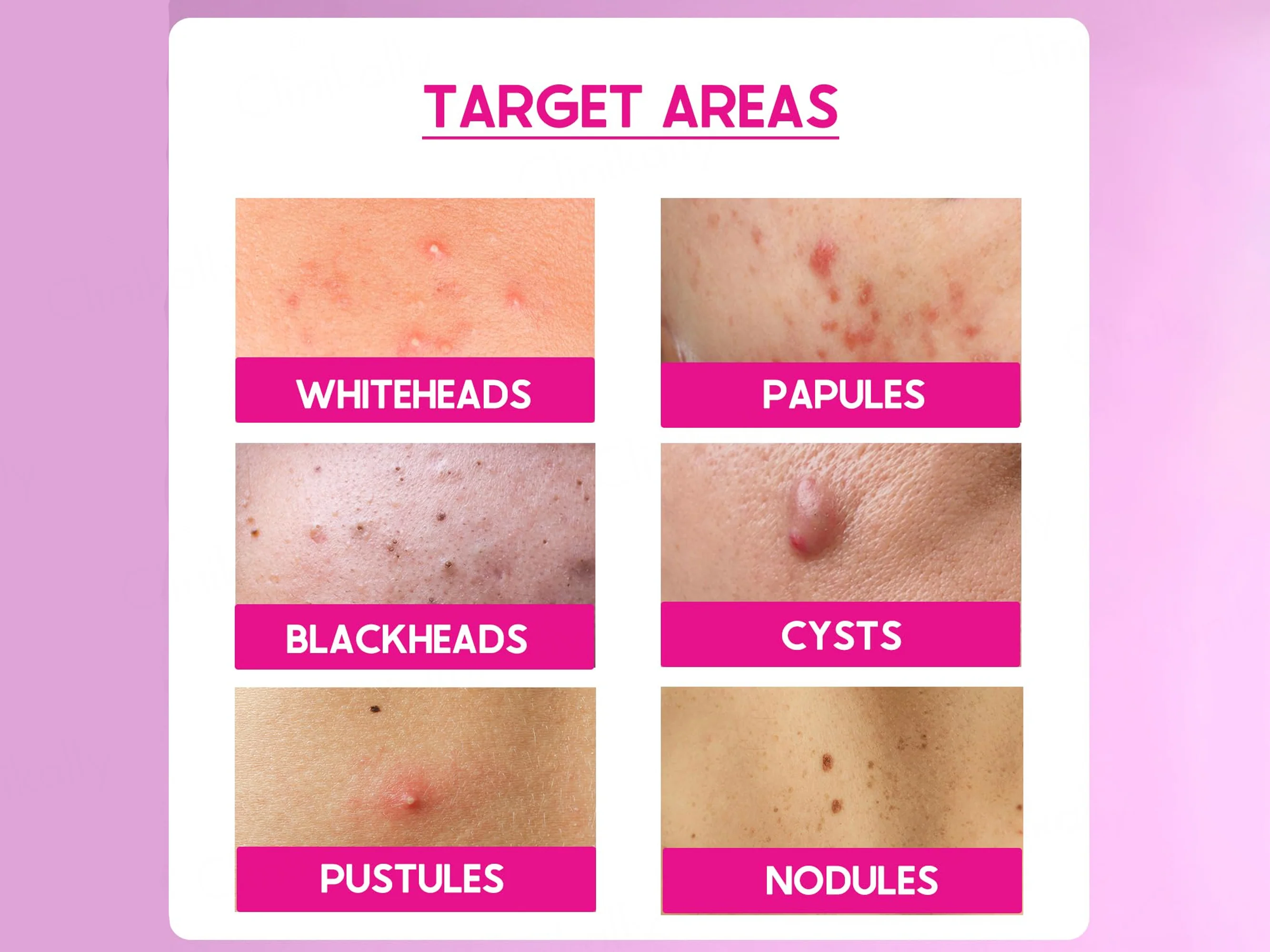 CosiQ ABP-11% AHA + BHA + PHA Gentle Exfoliating Peeling Solution - Image 5