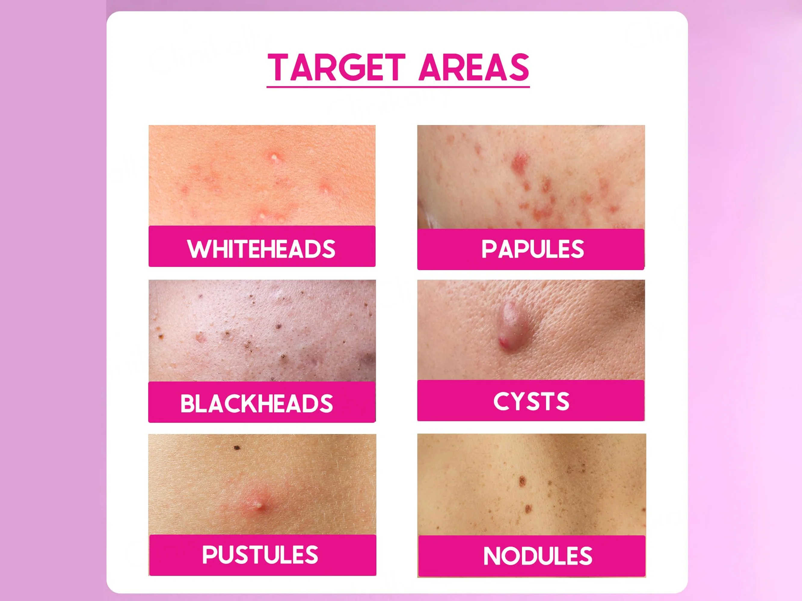 CosiQ ABP-33% AHA + BHA + PHA Strong Exfoliating Peeling Solution - Image 5