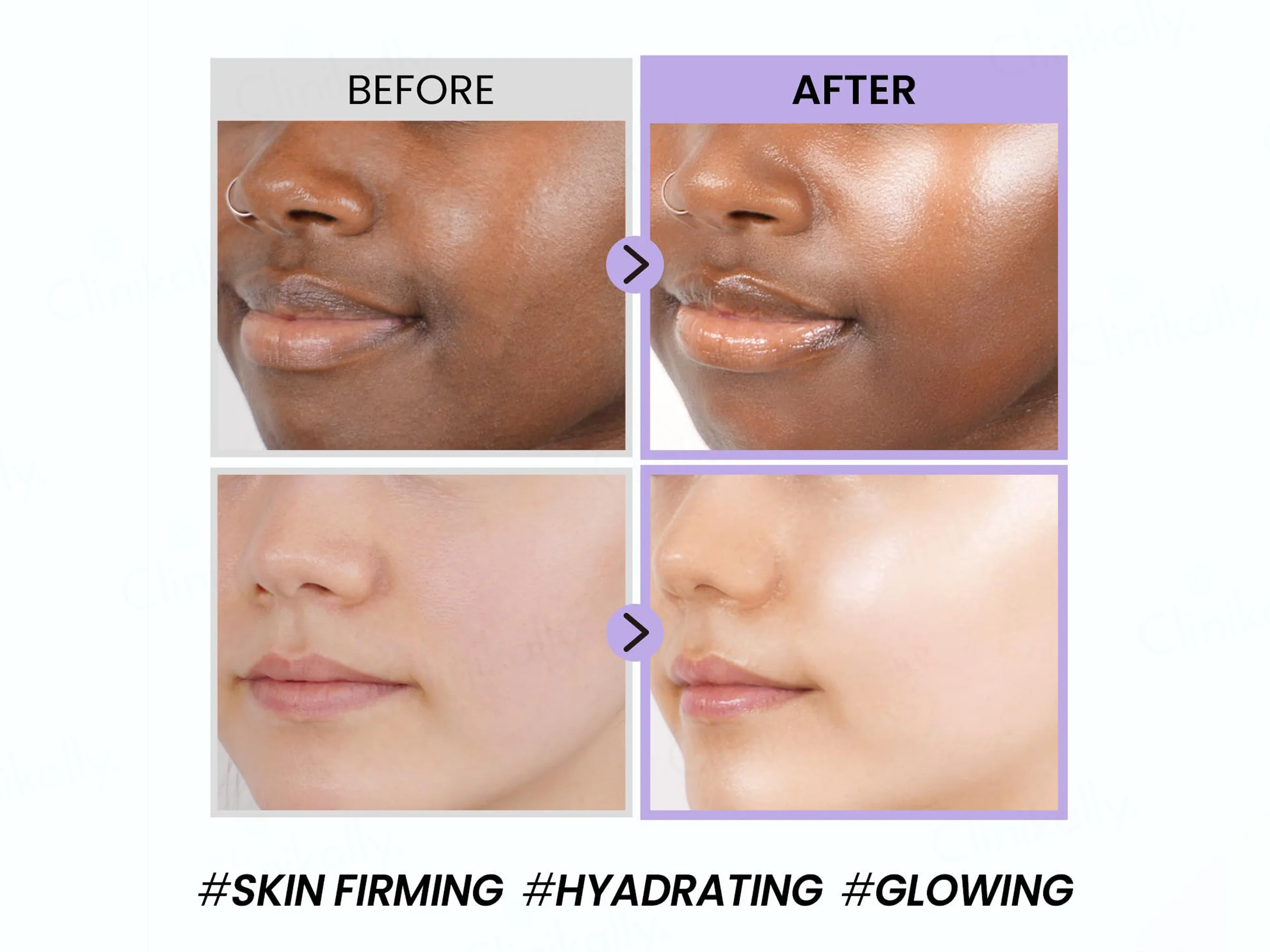 COXIR Black Snail Collagen Cream - Image 4