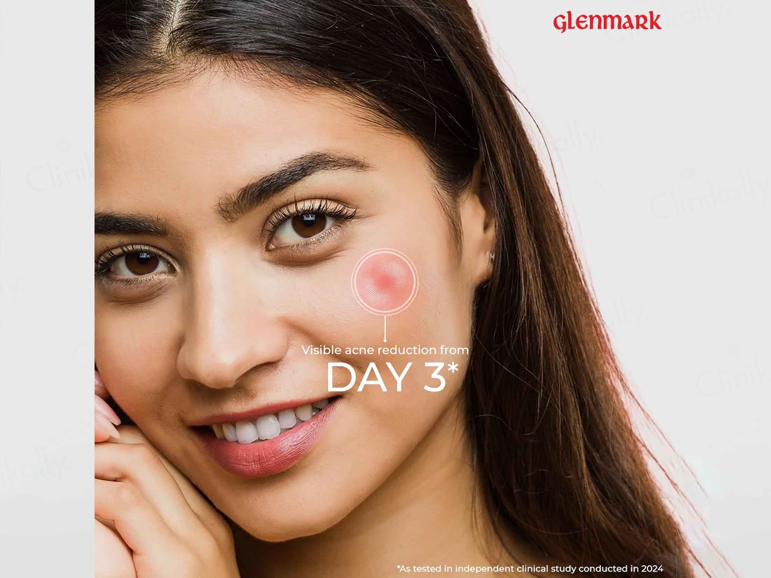 D'Acne Face Wash - Image 5