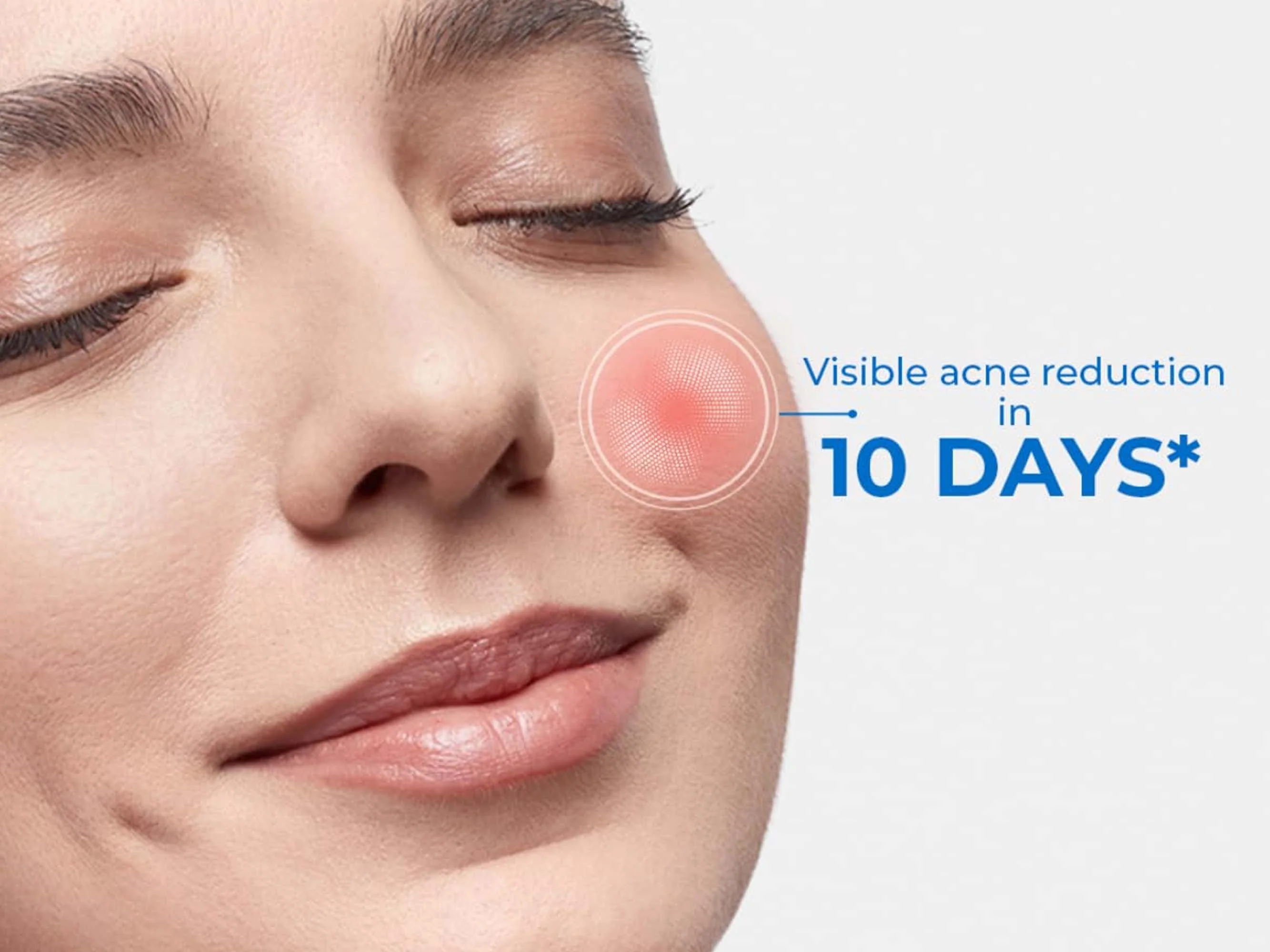 D'Acne Foaming Face Wash - Image 4