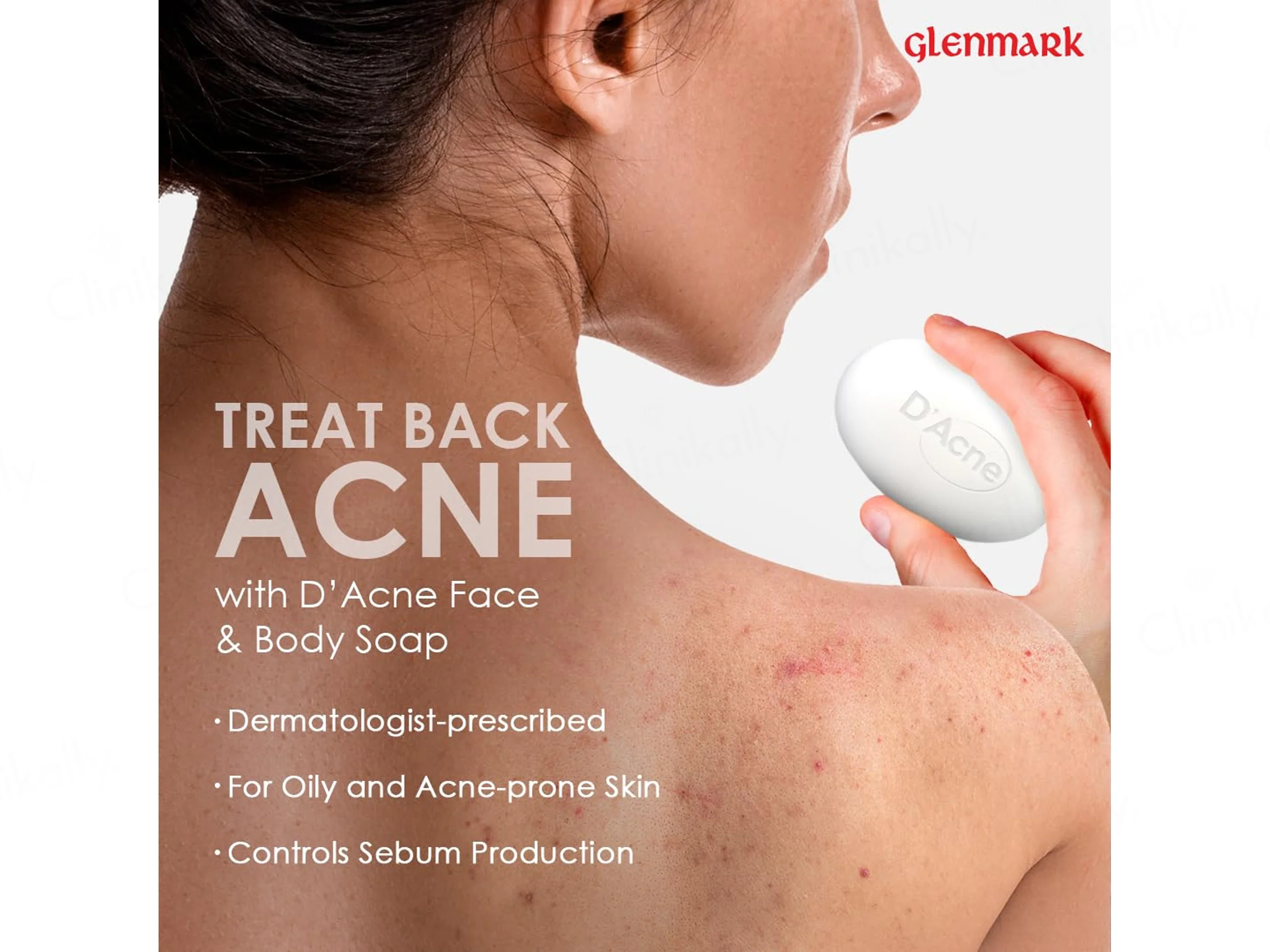 D'Acne Soap - Image 5