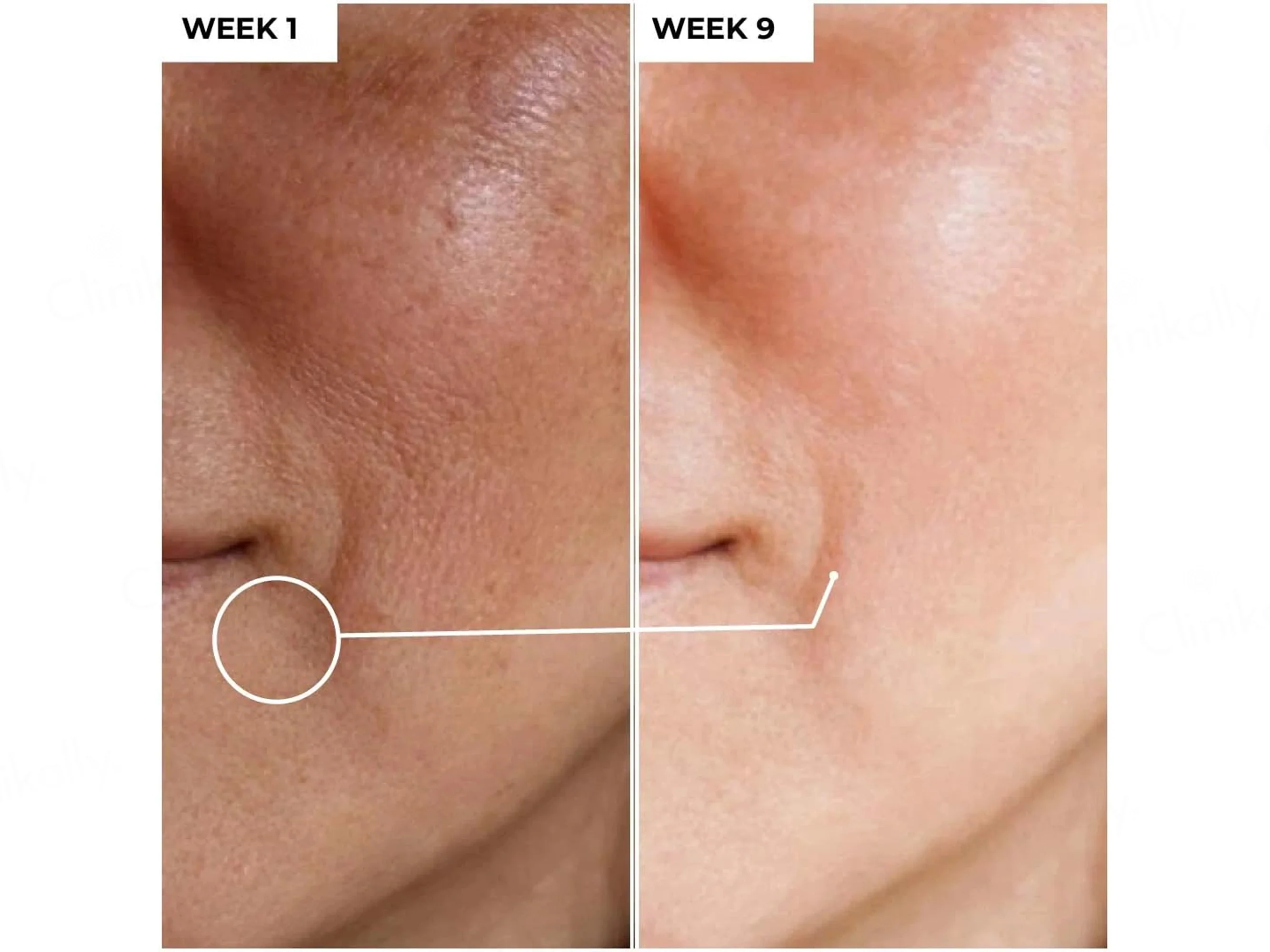 Dermabay 15% Vitamin C + 1% Hyaluronic Acid Face Serum - Image 5