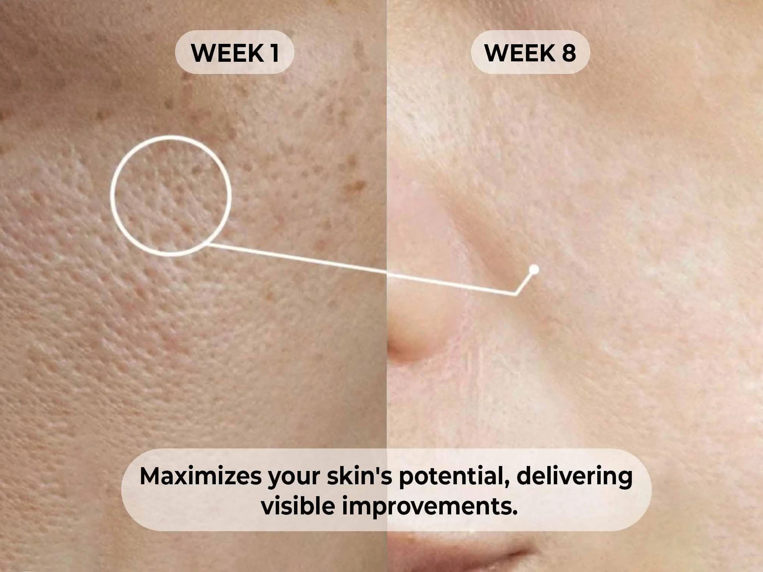 Dermabay 5% Niacinamide + 1% Hyaluronic Acid Face Serum - Image 9