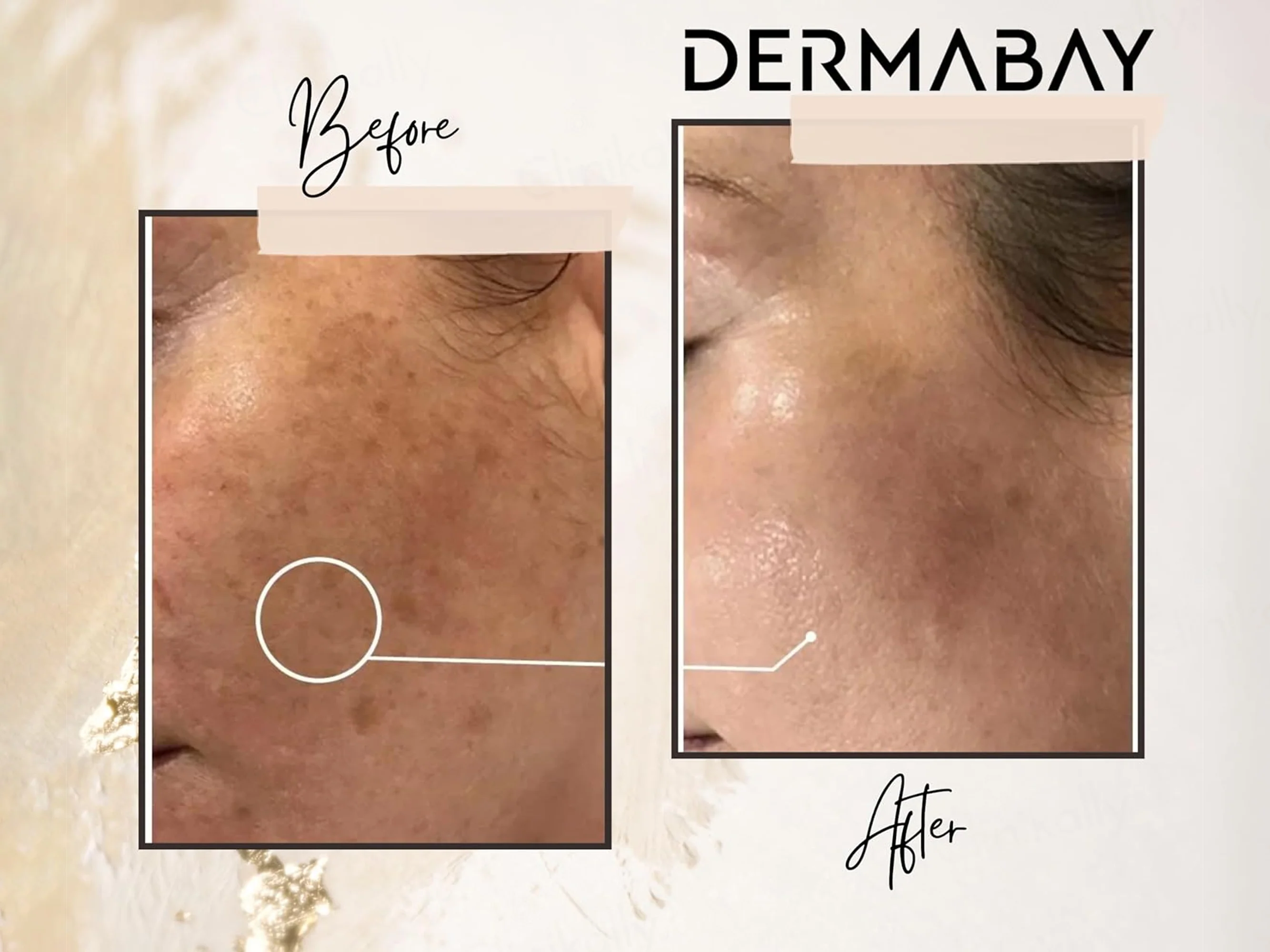 Dermabay Brightening Face Serum - Image 6