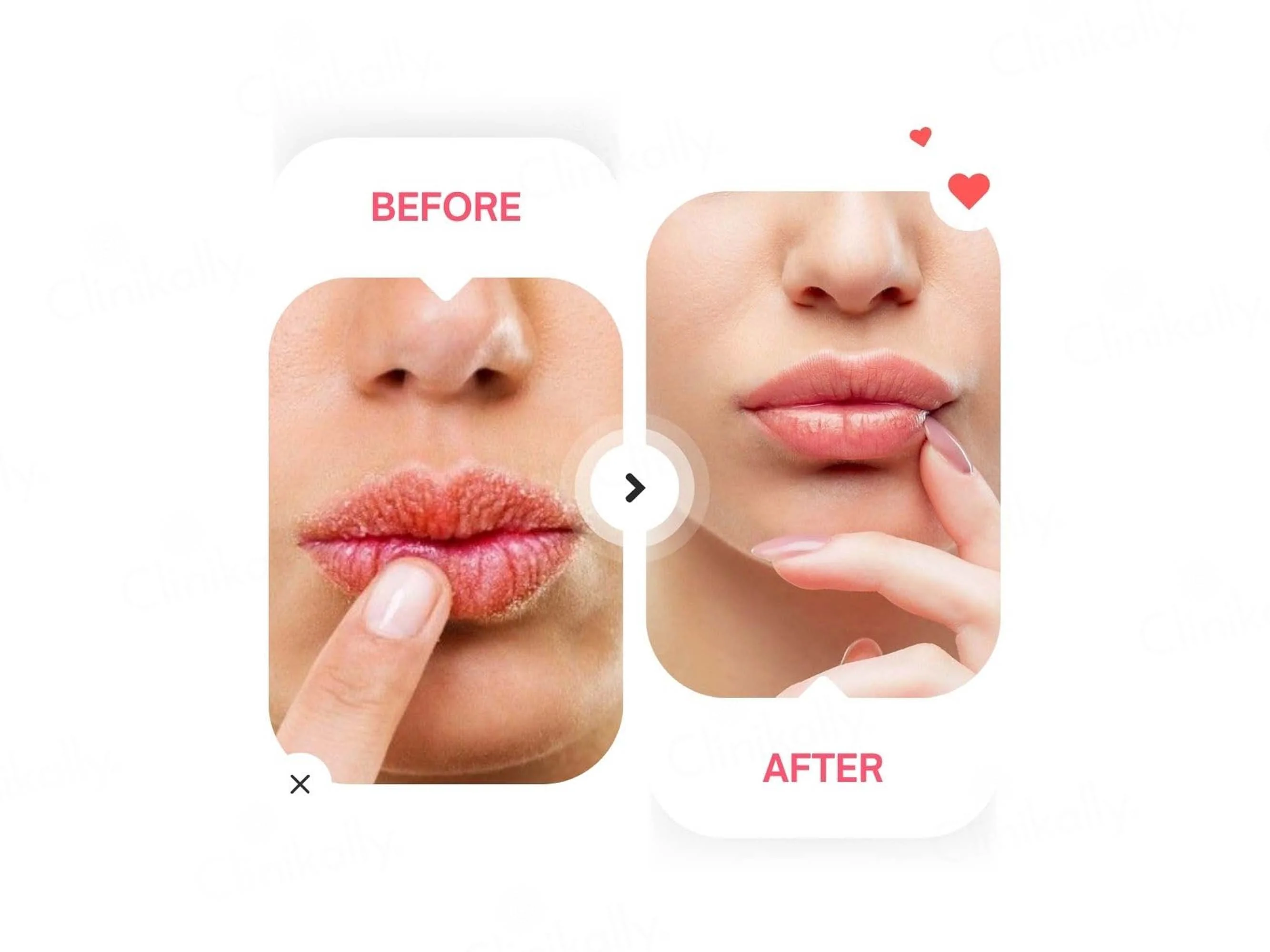 Dermina Ultra Hydrating Brightening Lip Balm - Image 2