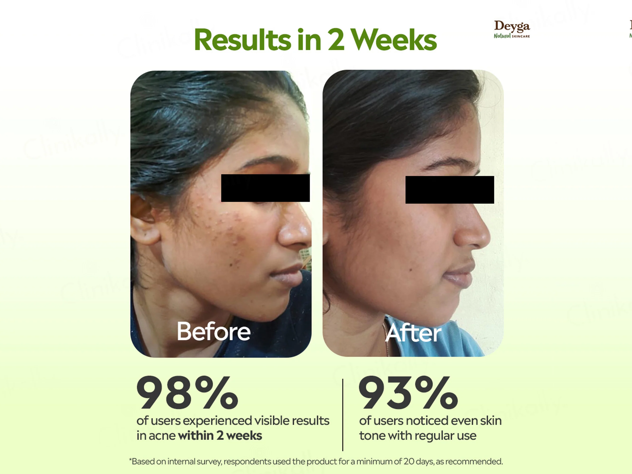 Deyga Aloe Vera Gel - Image 2