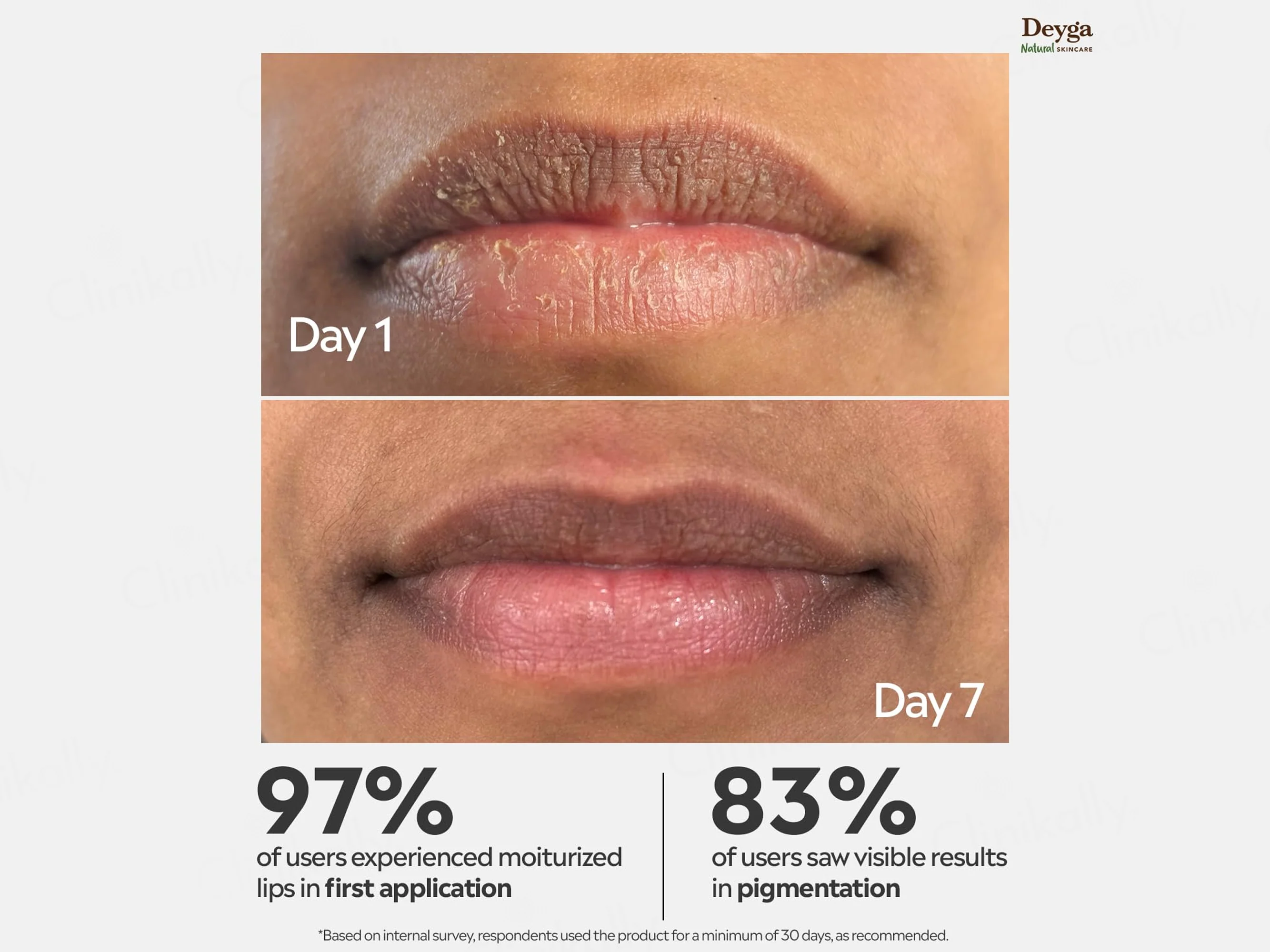 Deyga Beetroot Lip Balm - Image 2