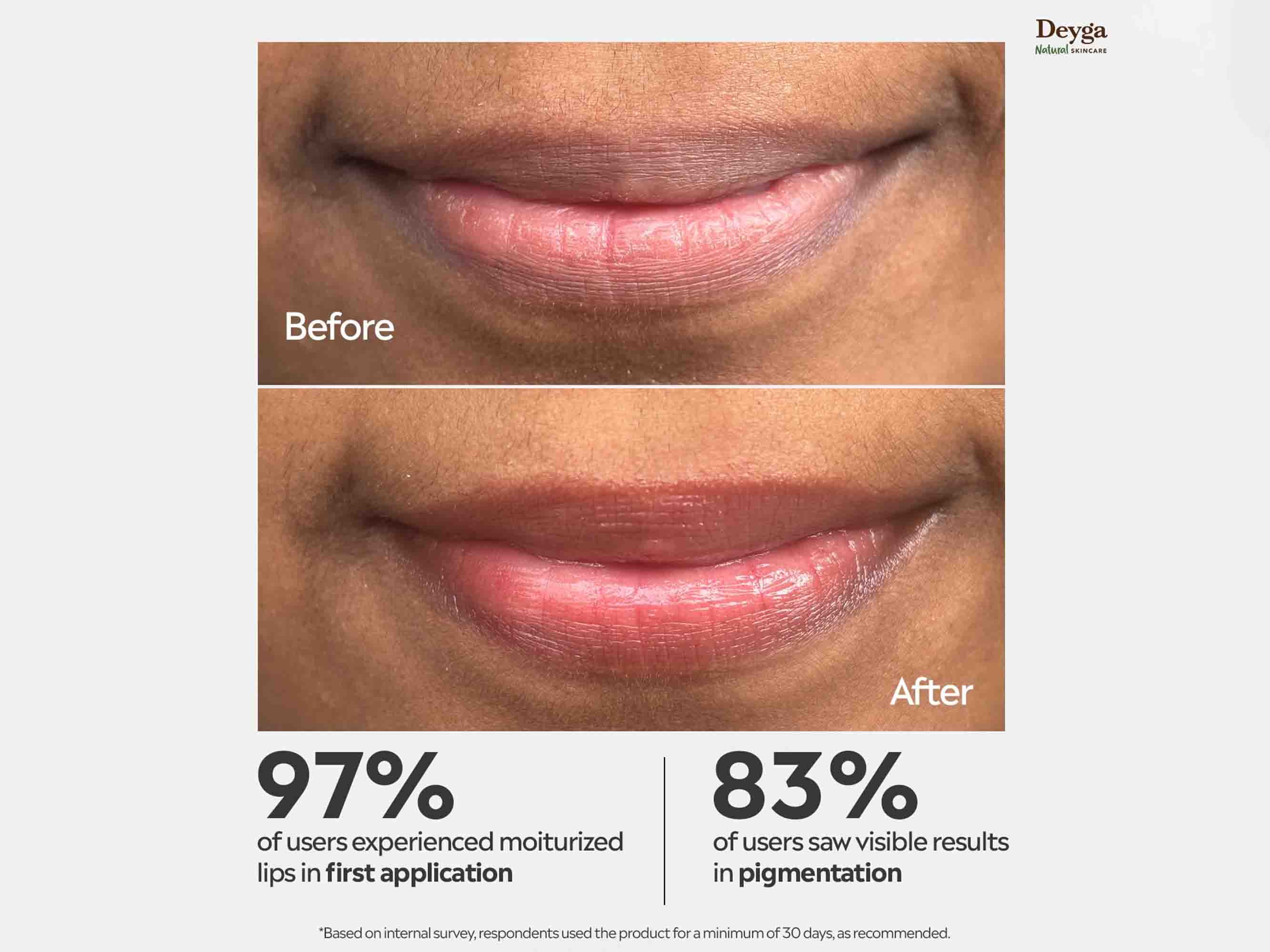 Deyga Beetroot Lip Balm 8Hrs+ Hydration - Image 2